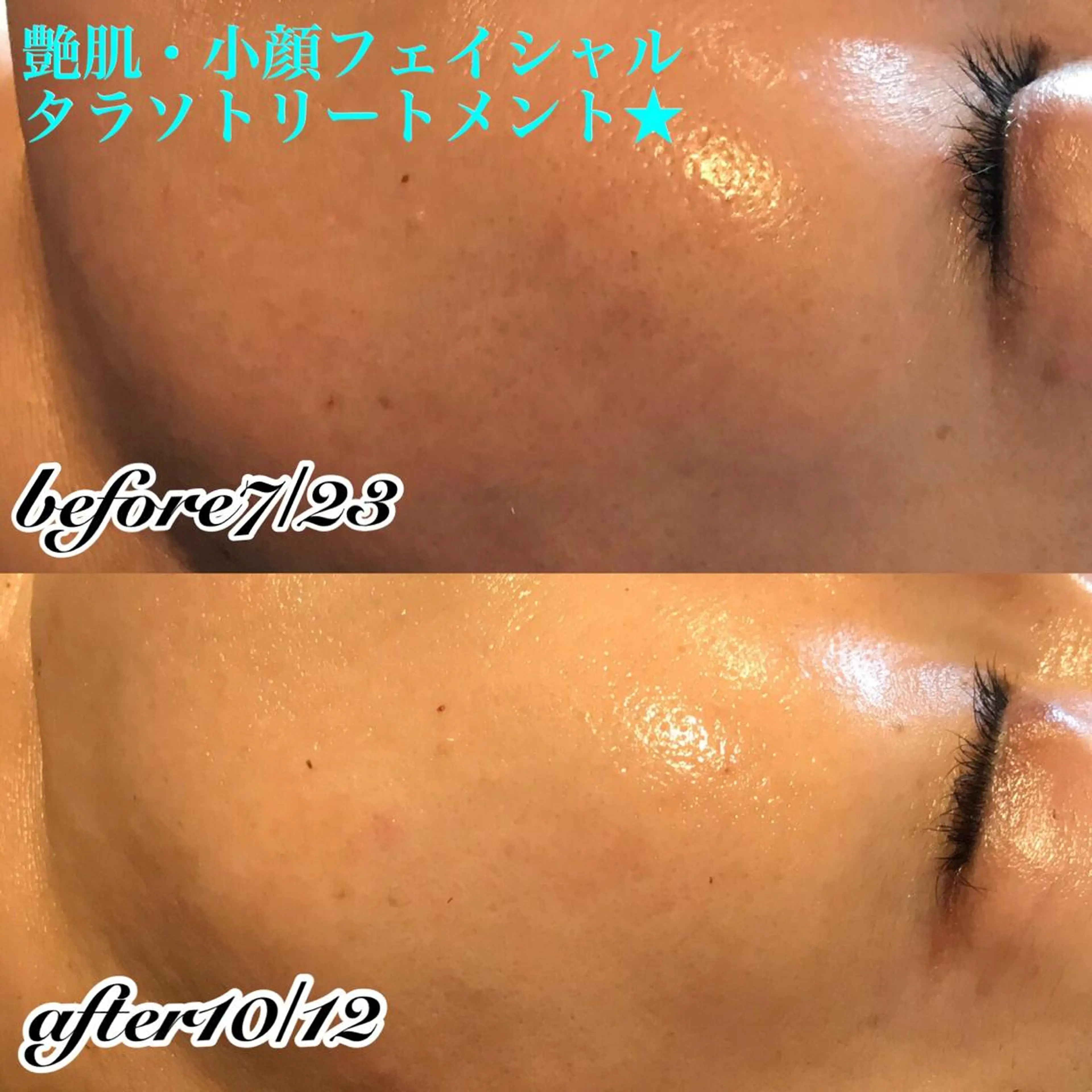 エステ 浜野 恵美のエステ・リラクイメージ