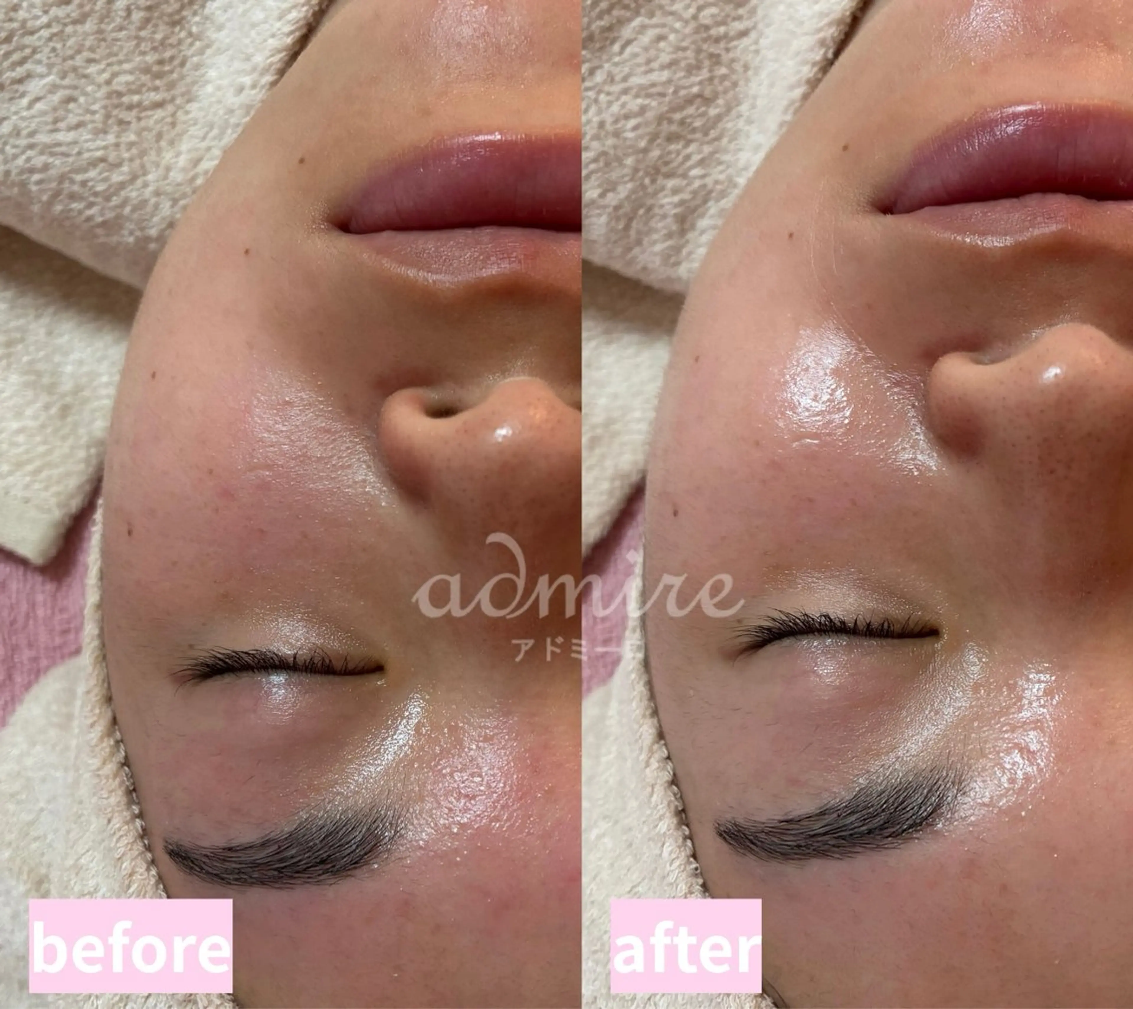 アドミーロ 🎀CHIKA🎀のエステ・リラクイメージ