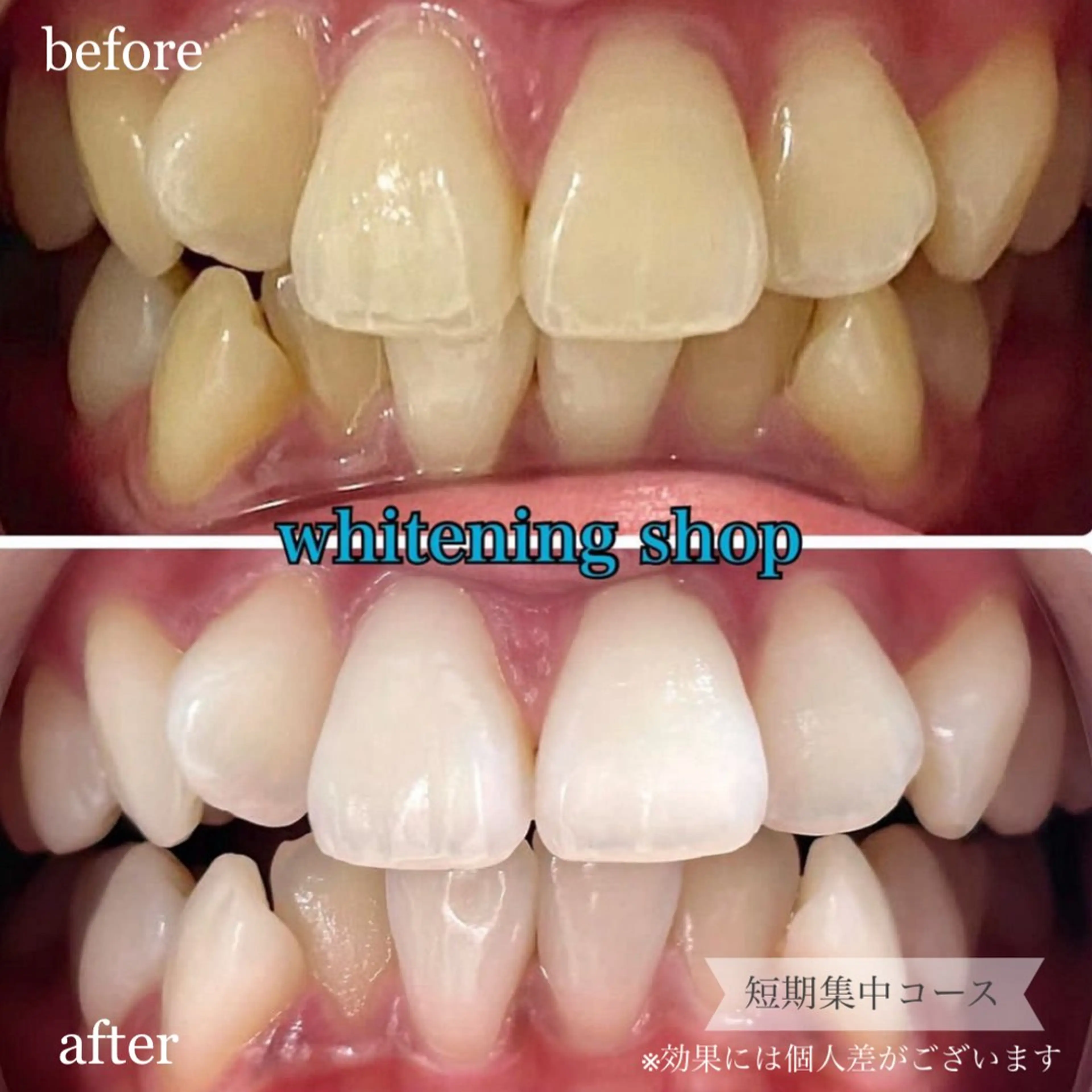 ホワイトニングショップ桜木町店所属・ホワイトニング ショップ桜木町店のエステ・リラクイメージ