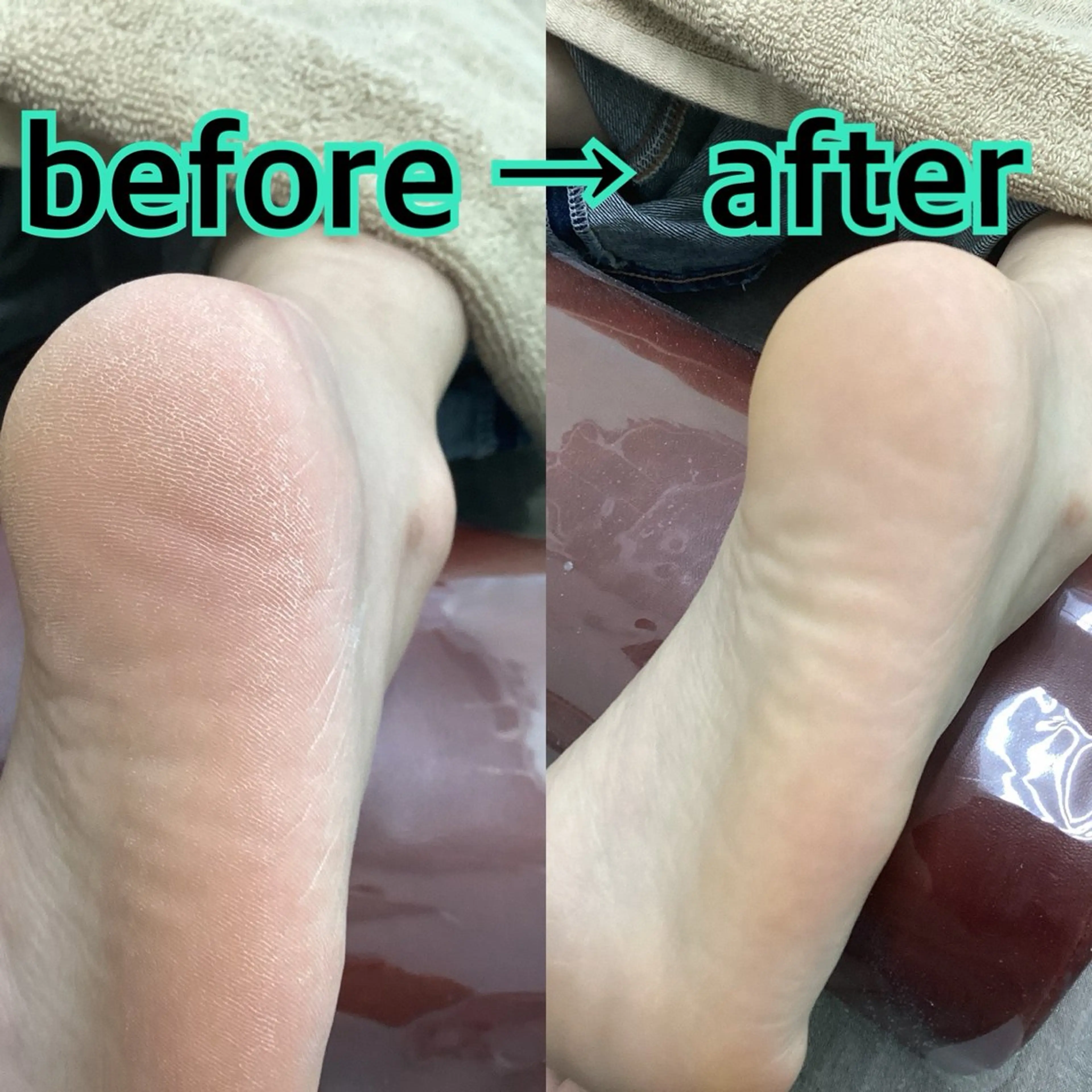 リラク ヒューマン 鍼灸接骨院所属・リラク/ネイル/ 足裏ケア/蛭川栞のエステ・リラクイメージ