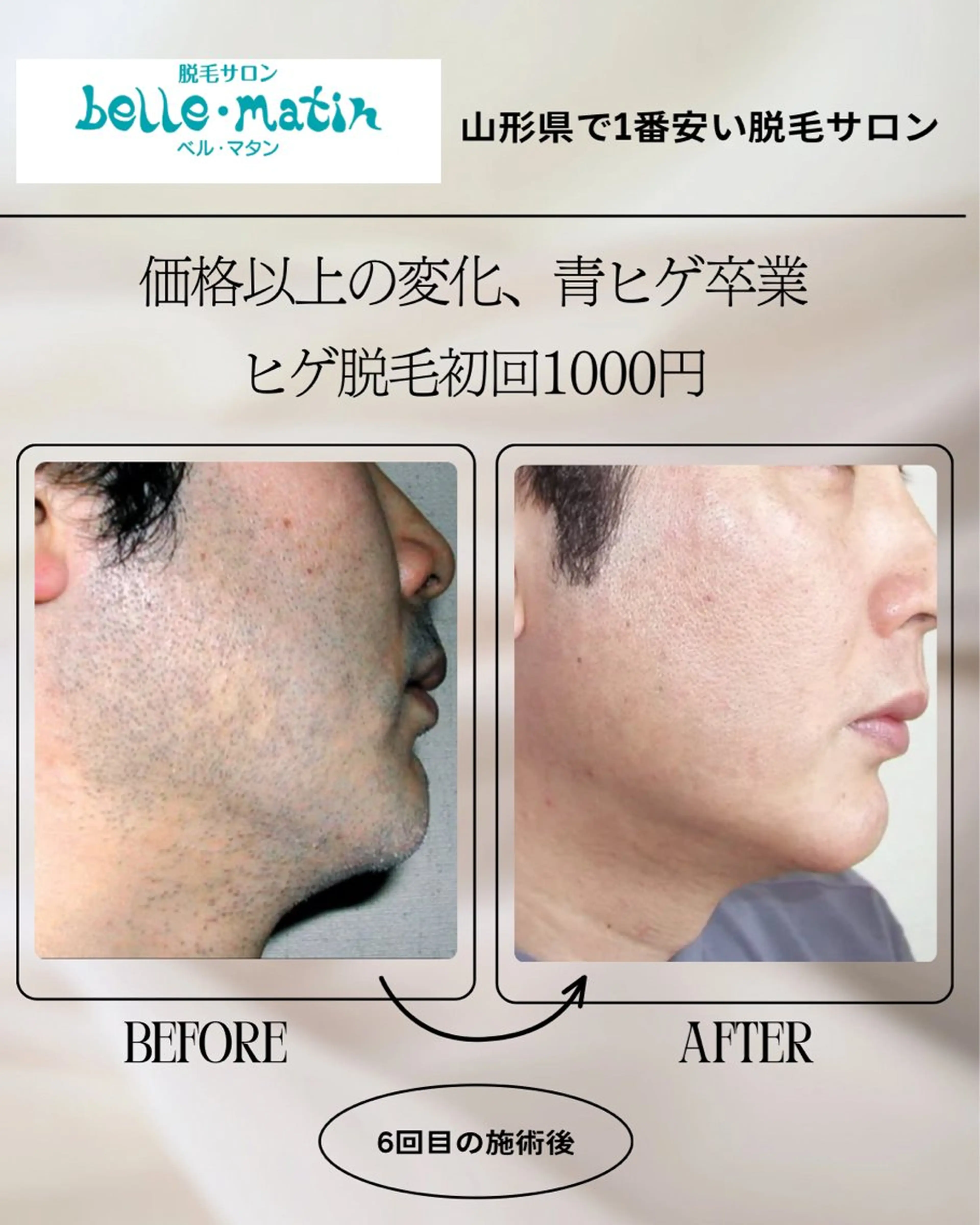 脱毛 脱毛サロン ベル・マタンのエステ・リラクイメージ