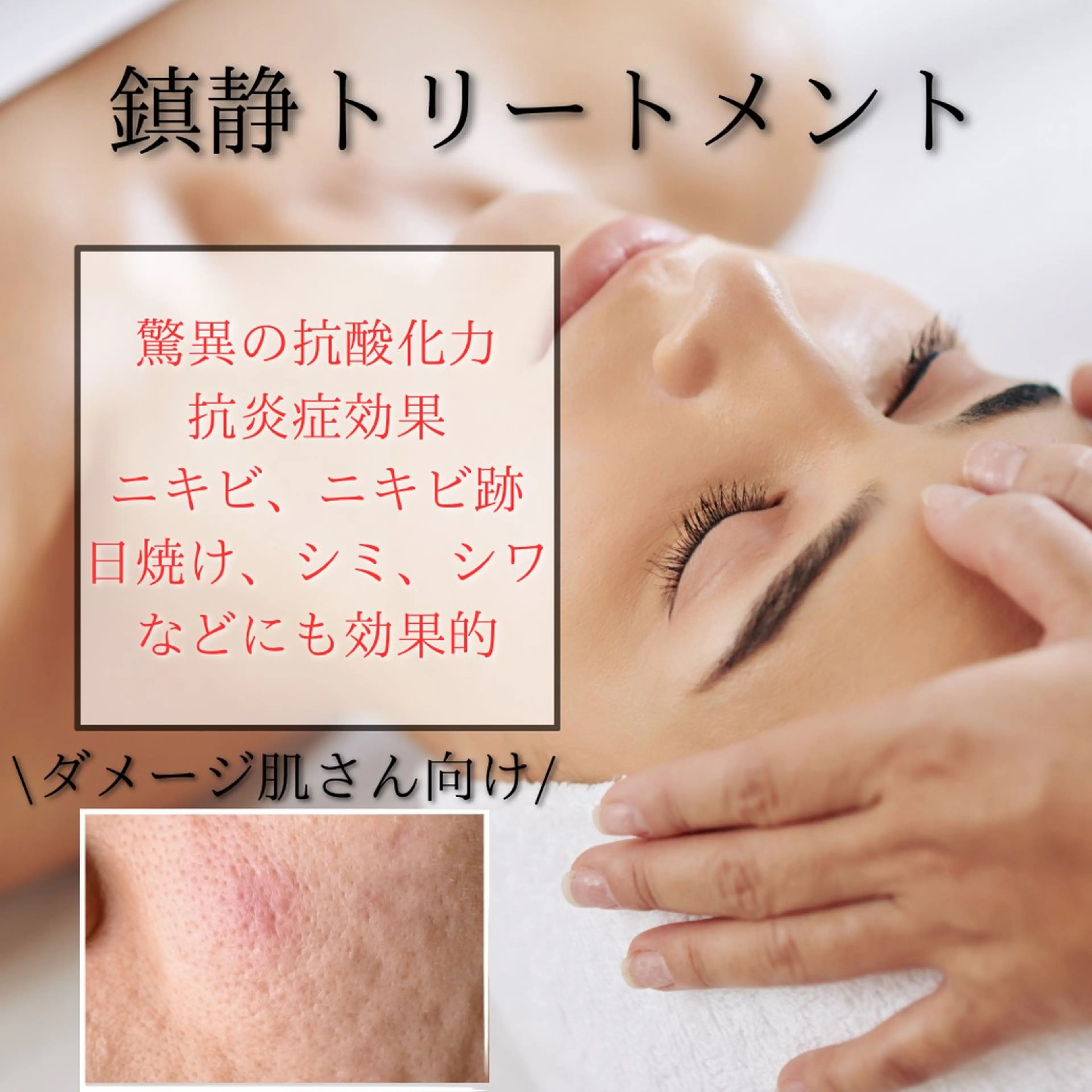 【ダメージ肌/ニキビケア向け】鎮静.肌育トリートメント+デコルテ+ドライヘッド¥10420→の写真