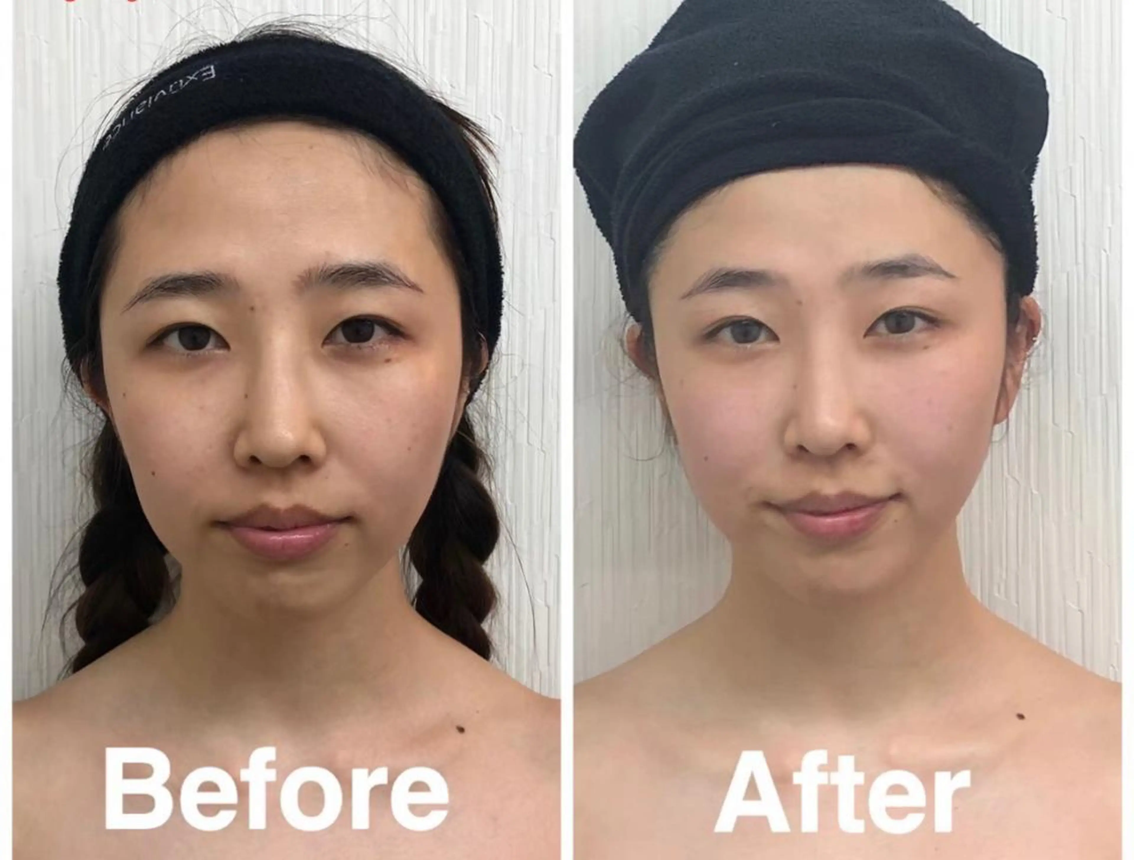 コルギモニター5回券(初回のみCRあり)みっちり50分🎶お顔もお身体もケア♡の写真