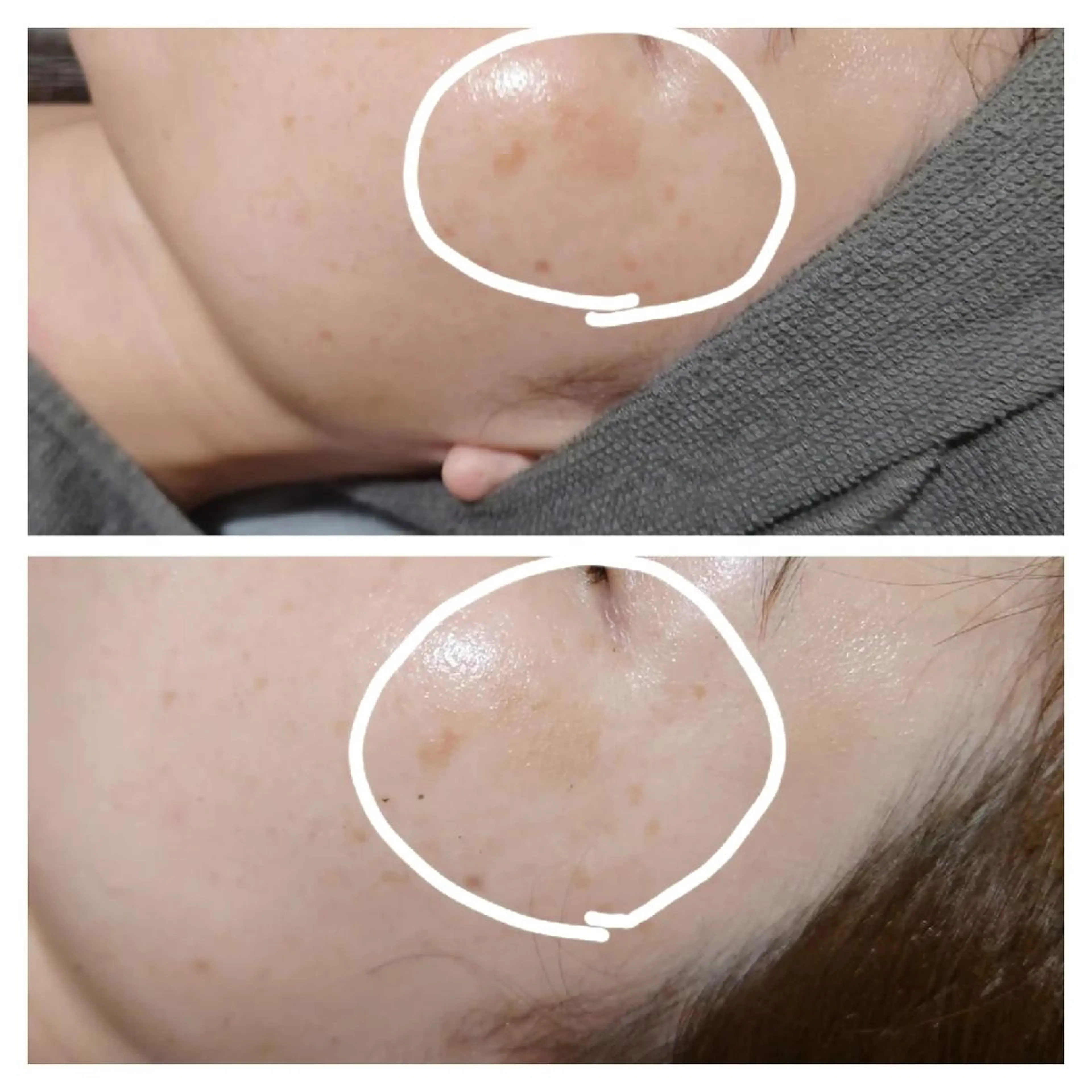 エステ Beauty Salon Luana所属・Luanaまつパ脱毛 ハーブピーリング眉毛のマツエク・マツパデザイン