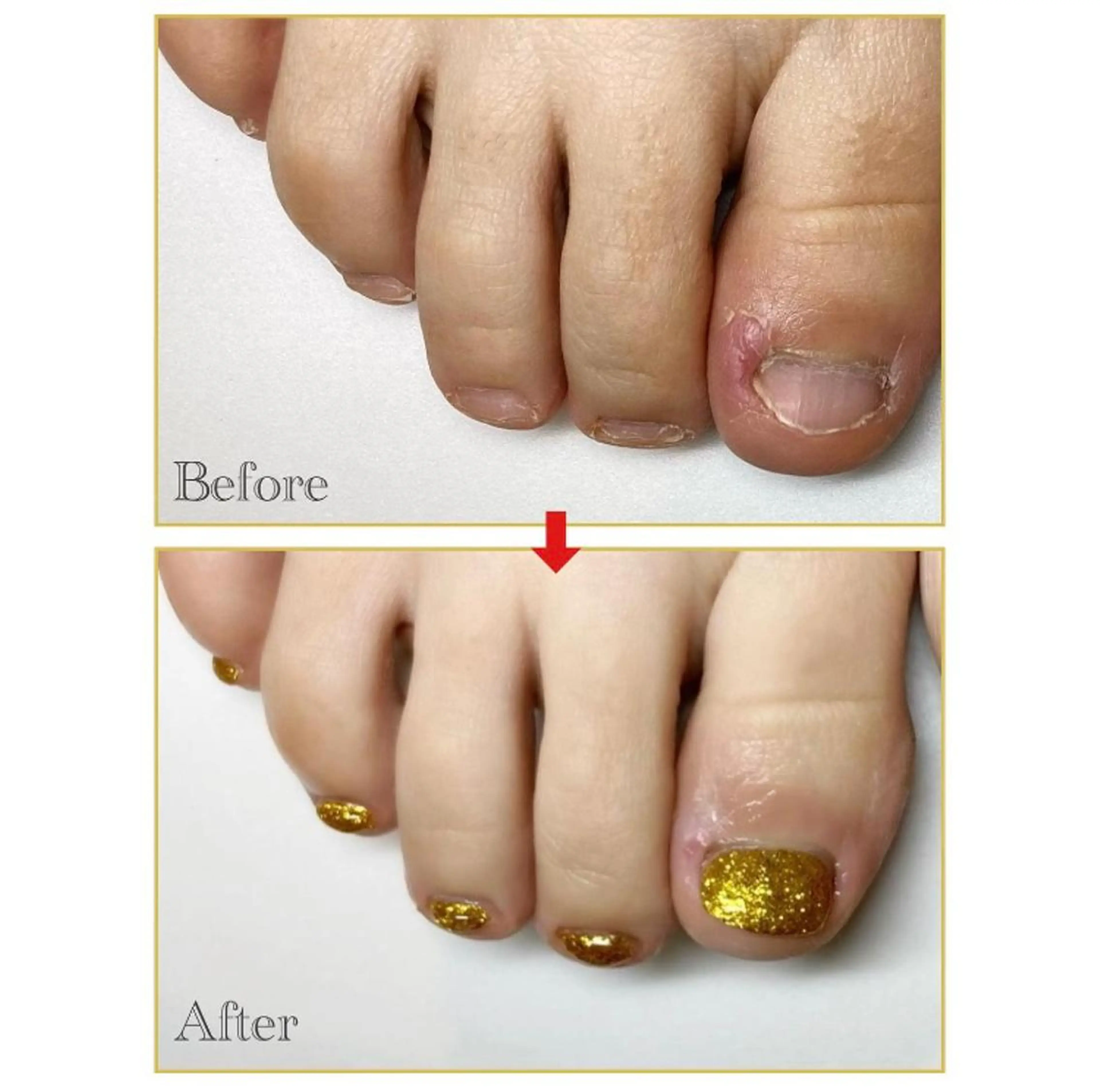 ネイル フットネイル ネイルサロン アリュームのネイルデザイン