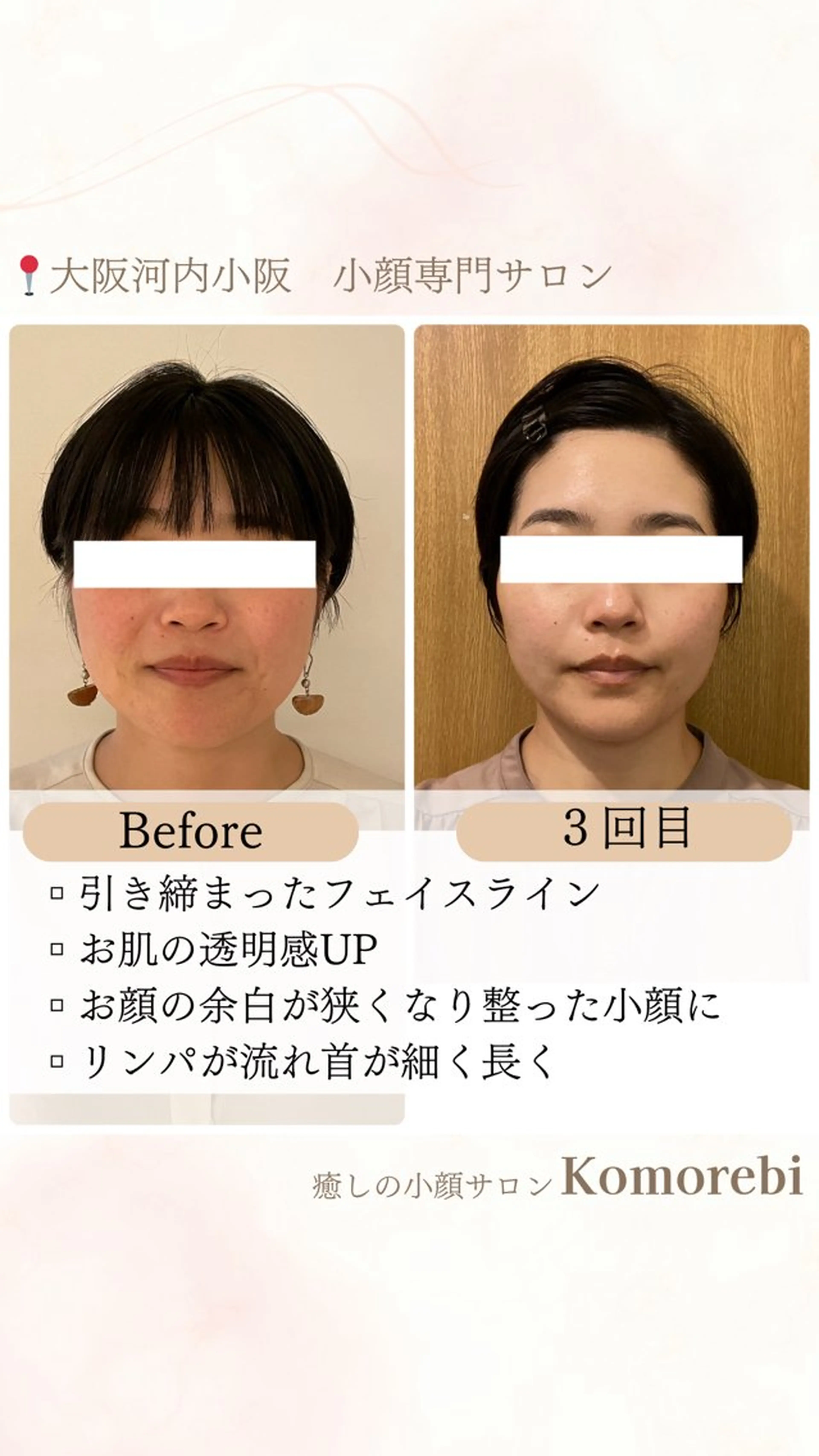 営業電話❌小顔サロン Komorebiのエステ・リラクイメージ