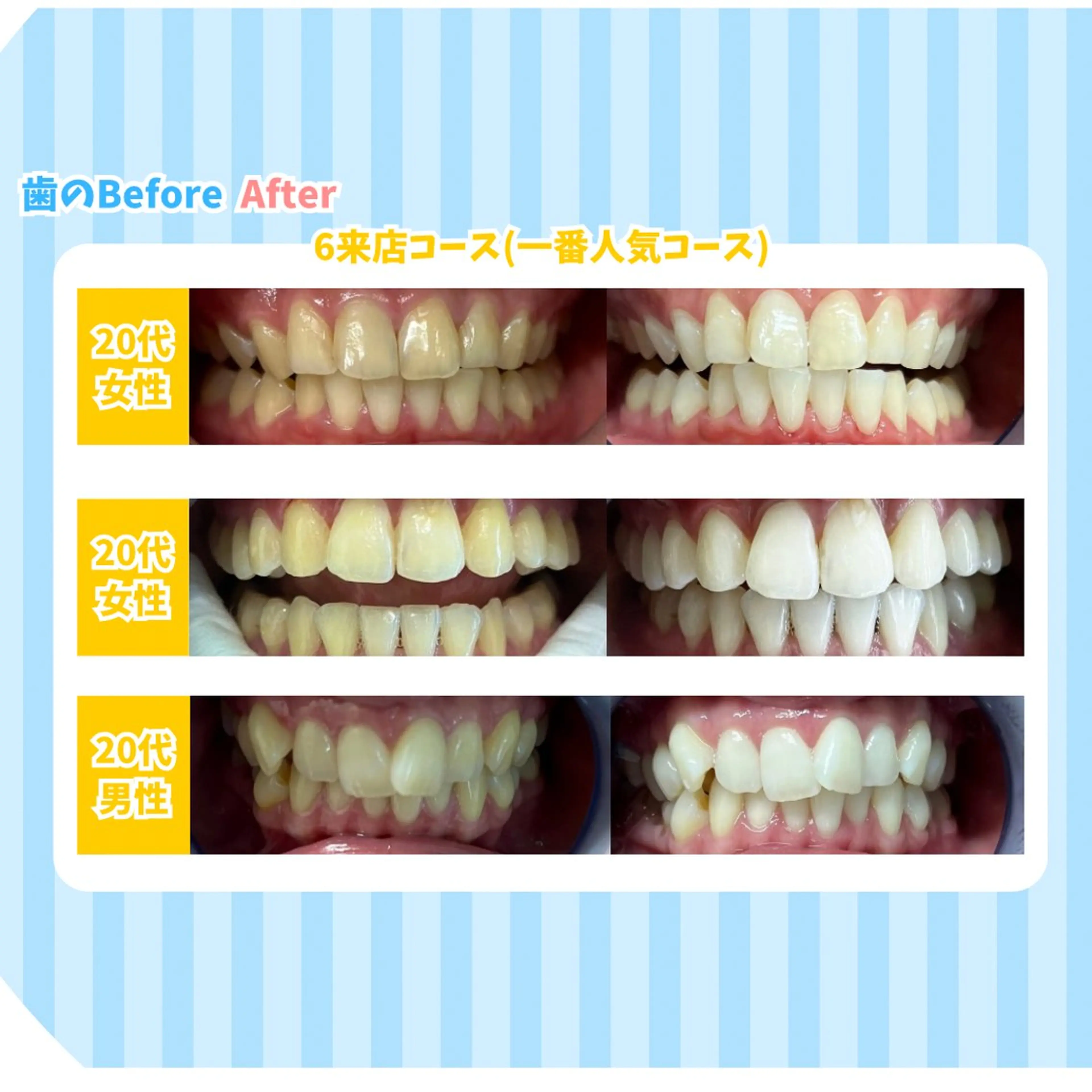 セルフホワイトニング Dolce水戸店のその他イメージ