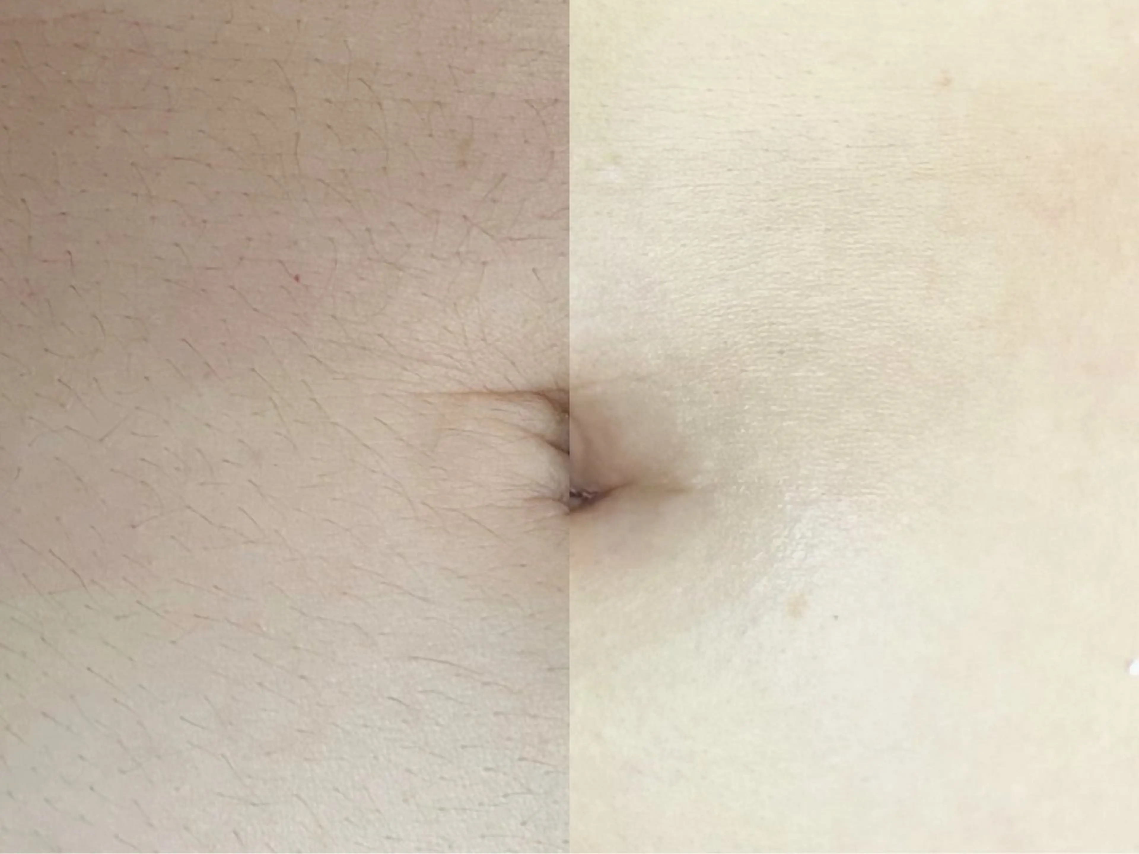 Hitomi シュガーリング豊橋のその他イメージ