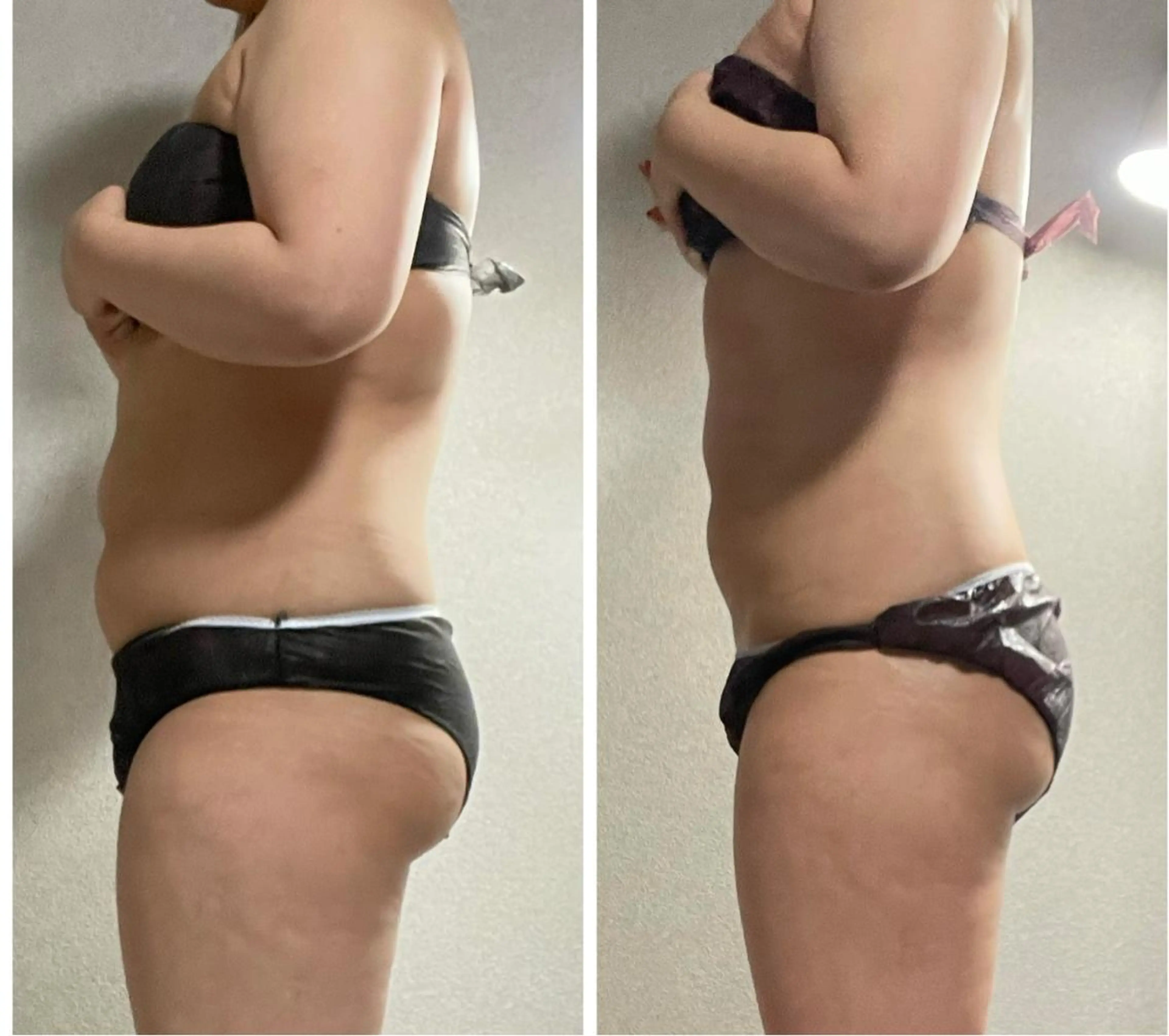 エステ エステ／ネイル/脱毛 R.Msalonのネイルデザイン