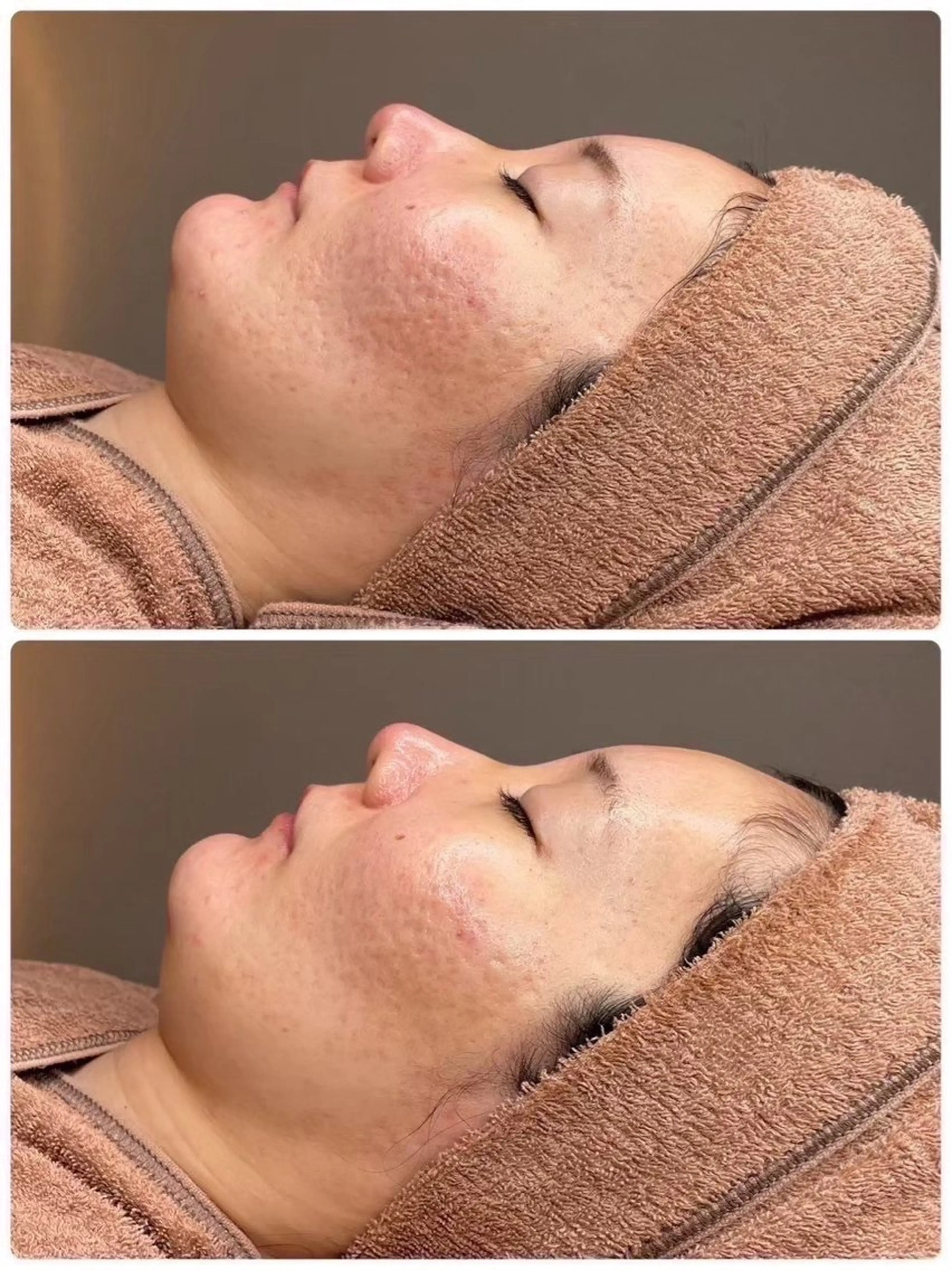 中目黒ハーブピーリン グ🌿ララピールのエステ・リラクイメージ