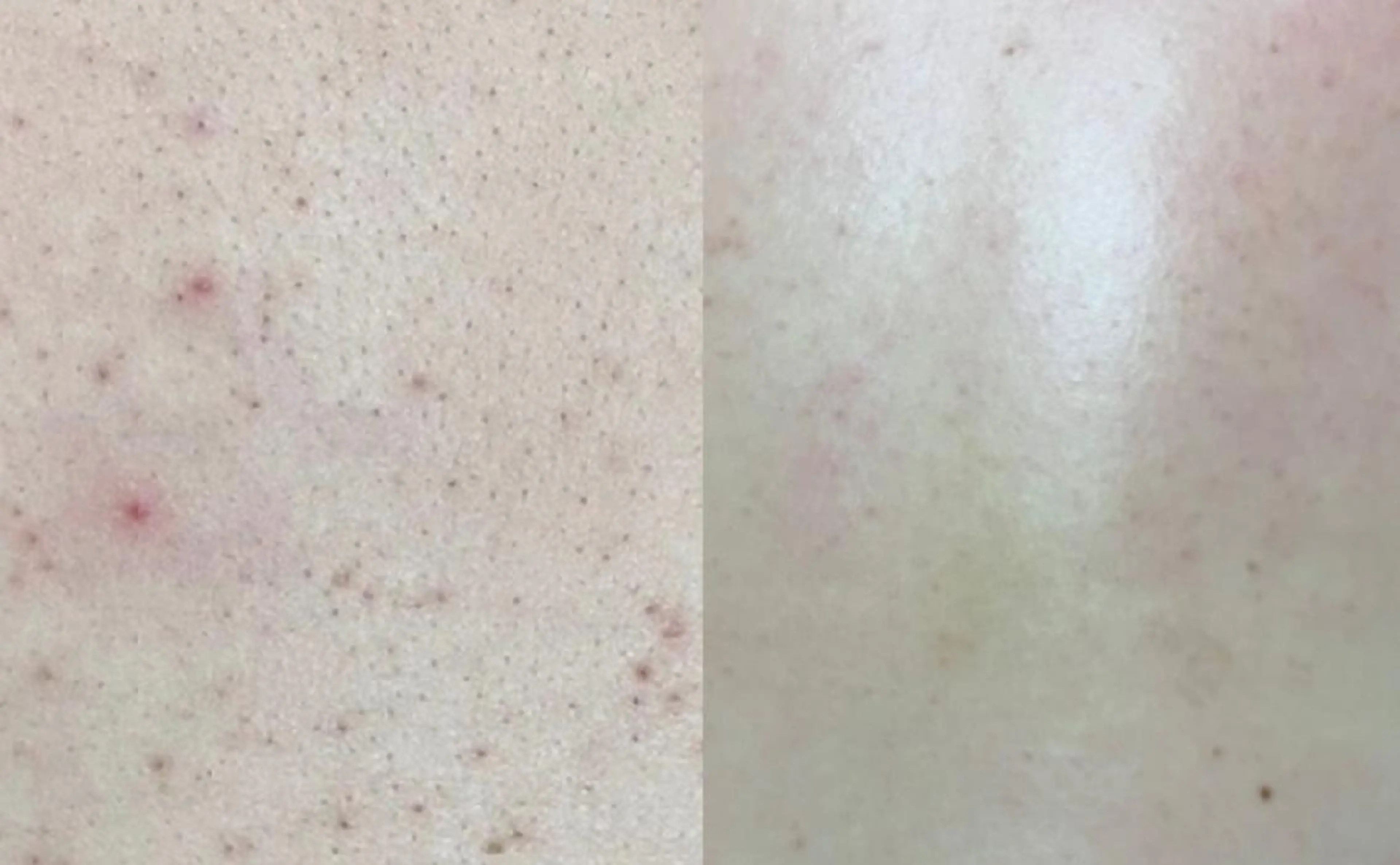 PIP🌹 さえのマツエク・マツパデザイン