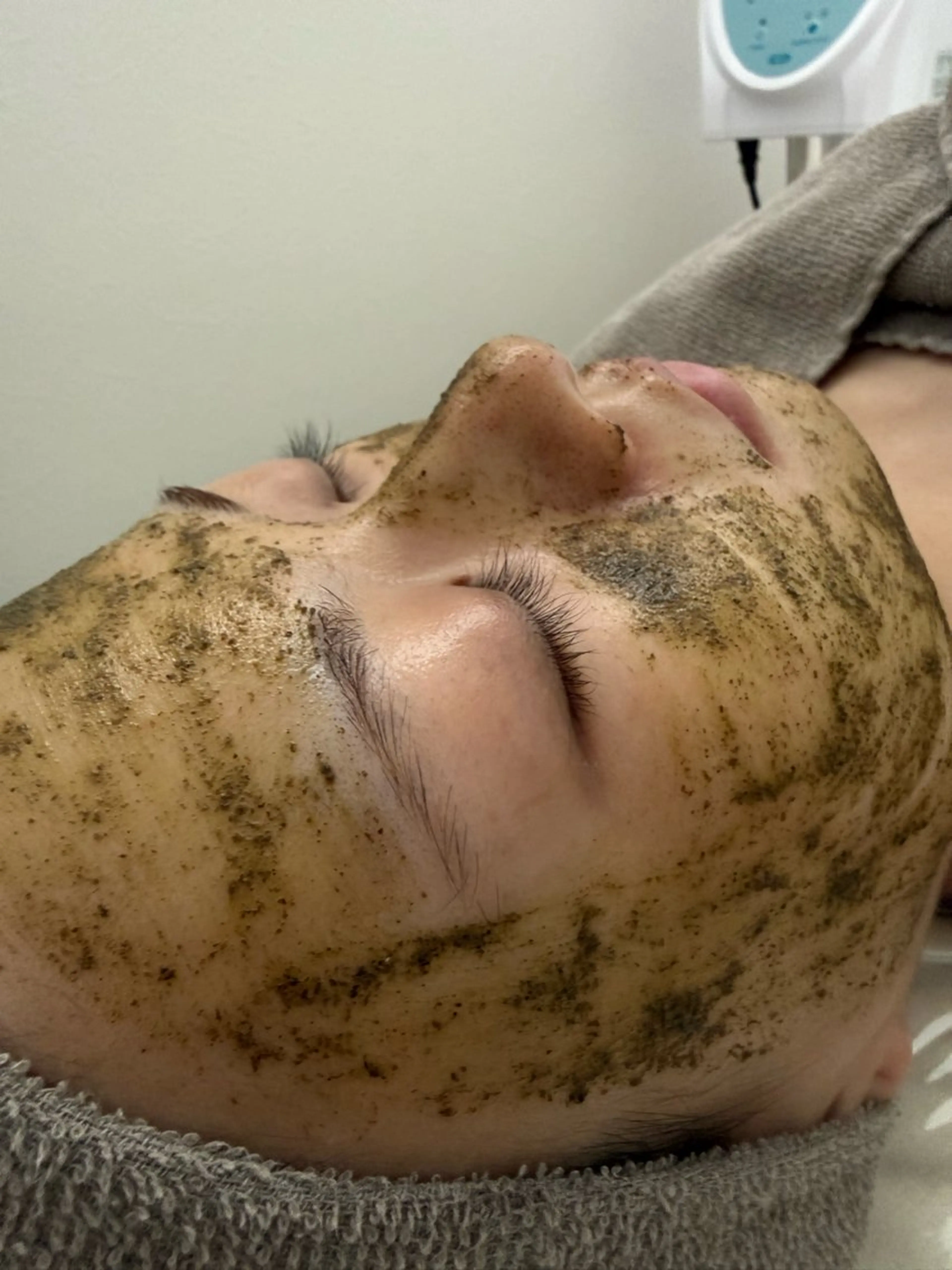 【ざらつき・ニキビ・くすみ改善】ハーブピーリング＋イラストリアス美白パック✨の写真