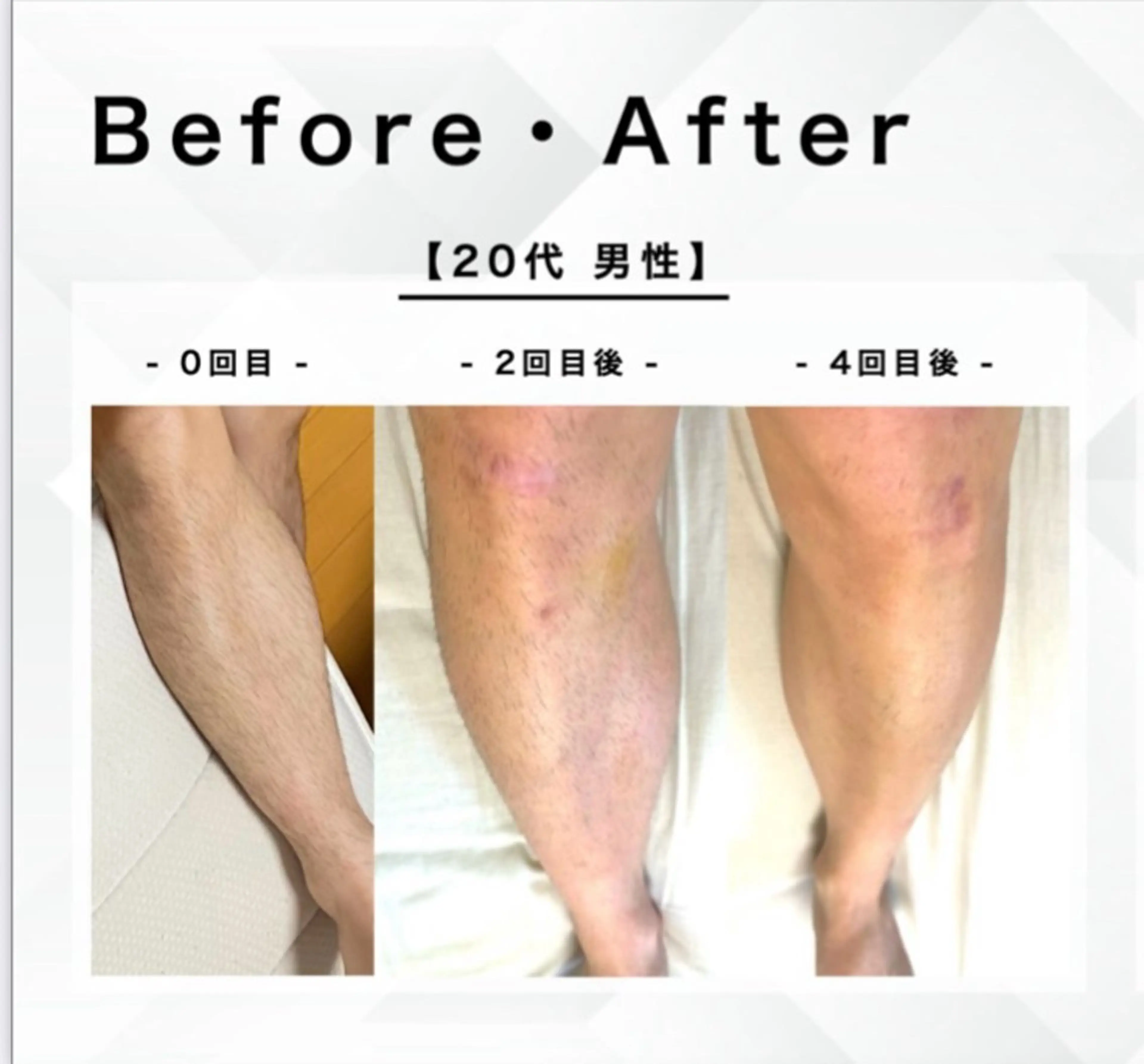 メンズ esthesalon O'-en-のエステ・リラクイメージ