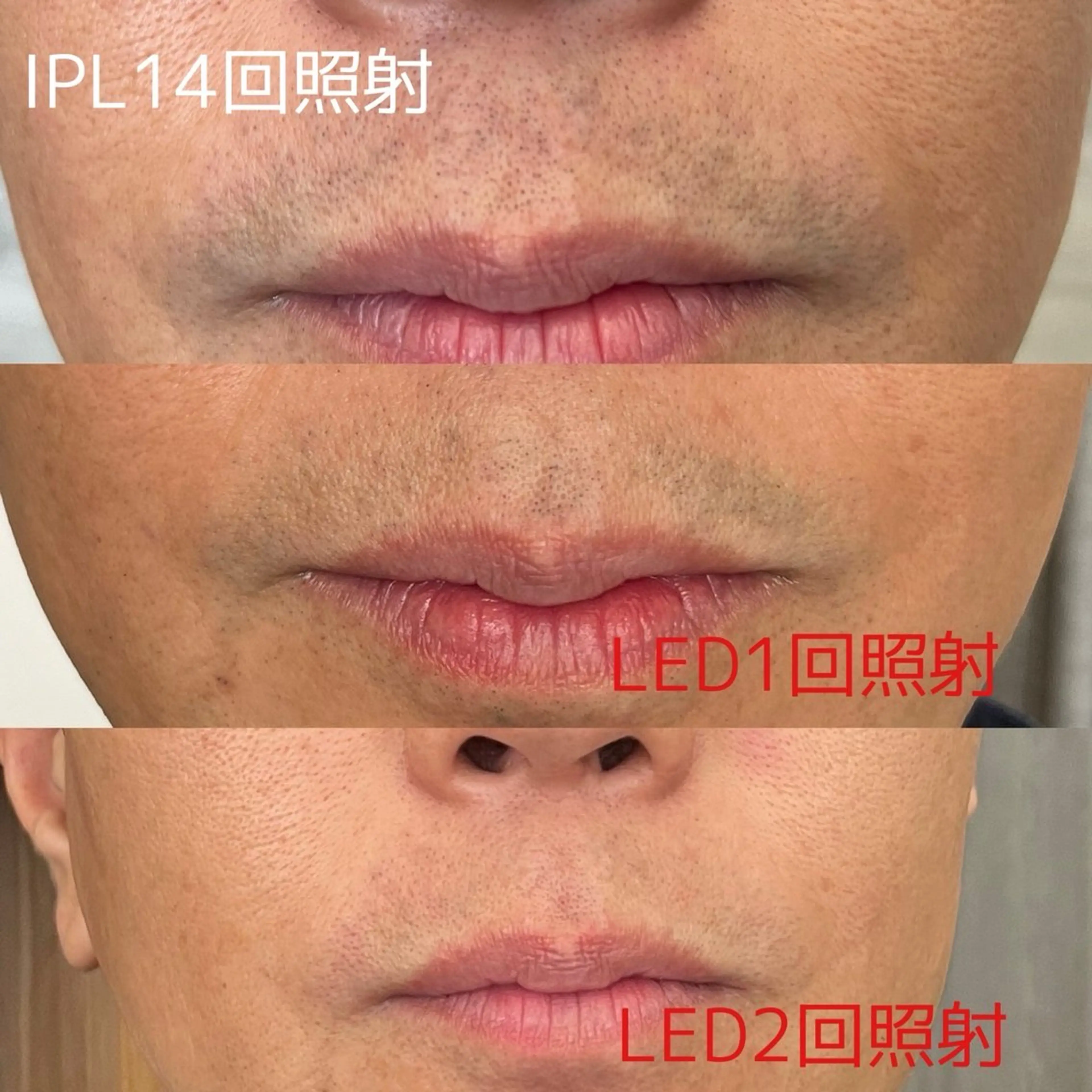 脱毛 篠原 由紀野のエステ・リラクイメージ