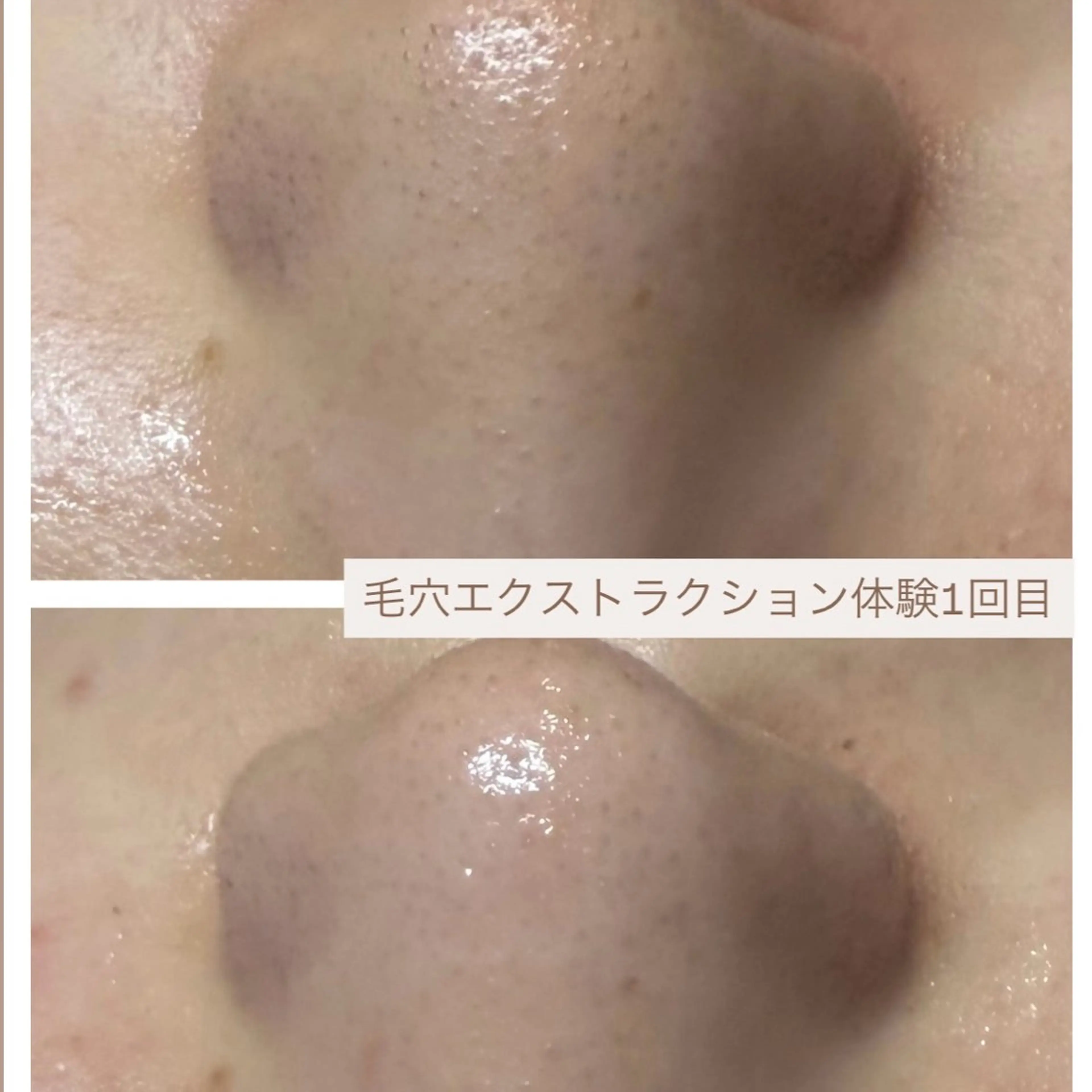 エステ uni. abeのエステ・リラクイメージ