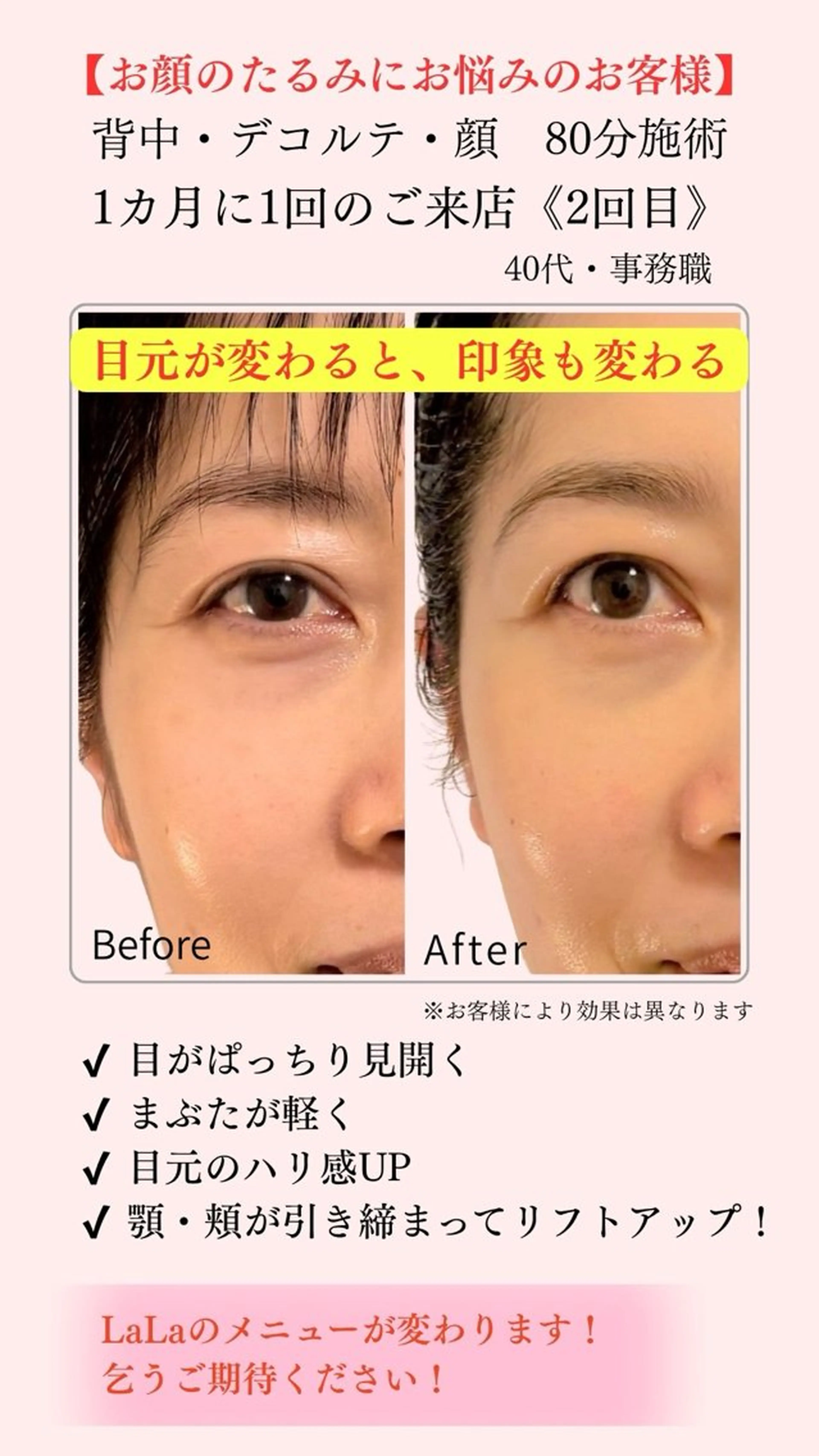 LaLa所属・小顔・たるみケア 専門店【LaLa】のエステ・リラクイメージ