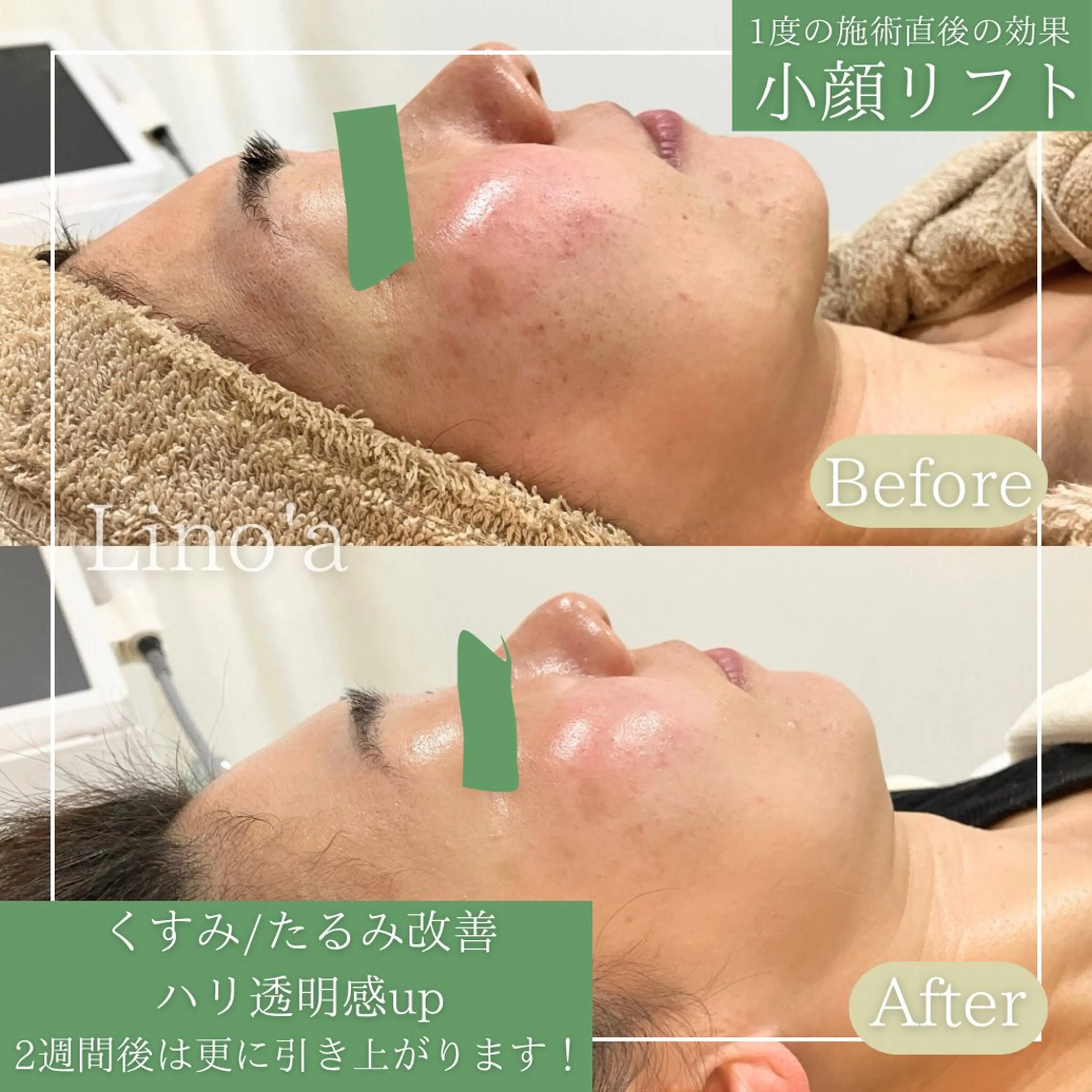 エステ リラク Salon💫 Lino'a柏店のエステ・リラクイメージ