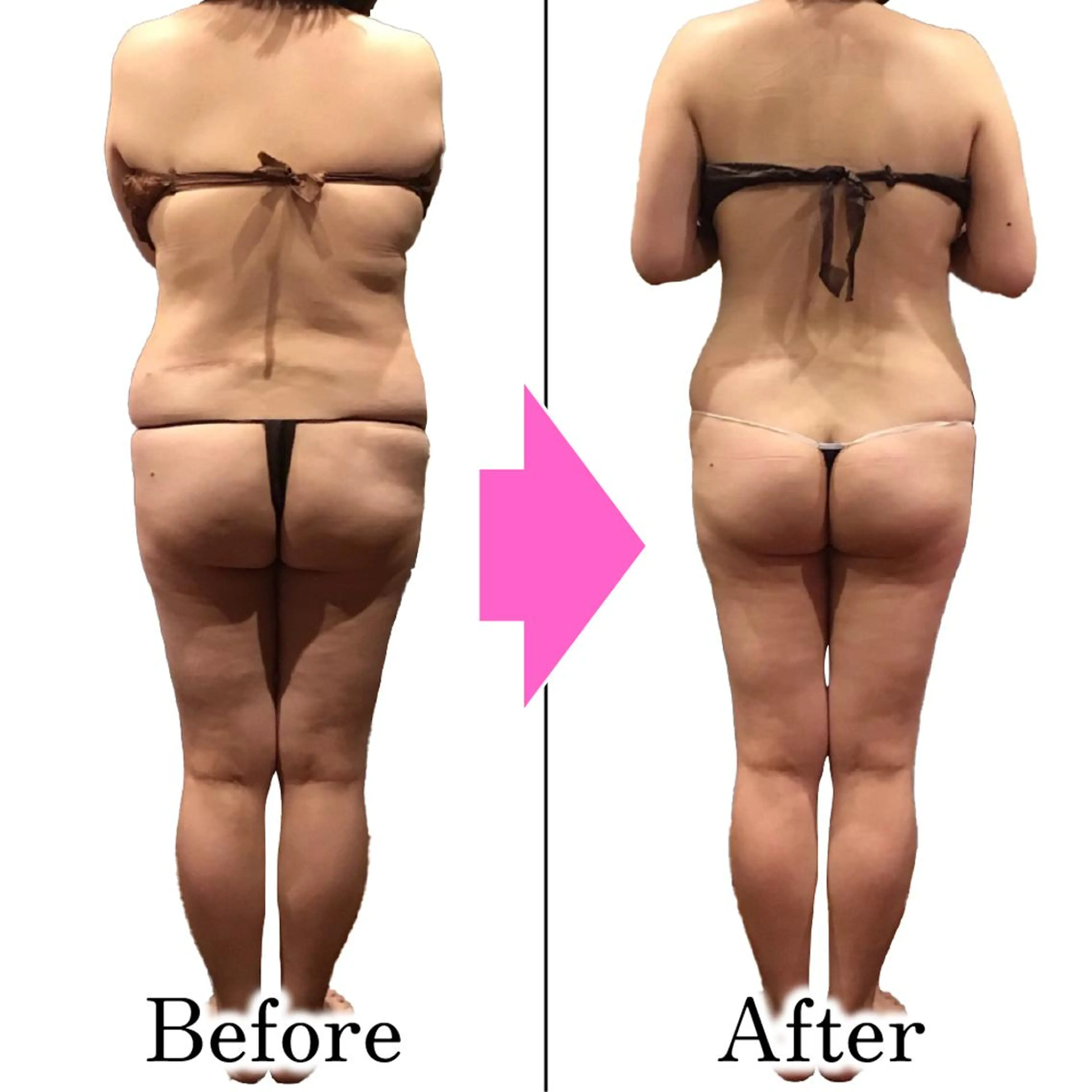 エステ ダイエットラボ梅田店 🌟のエステ・リラクイメージ