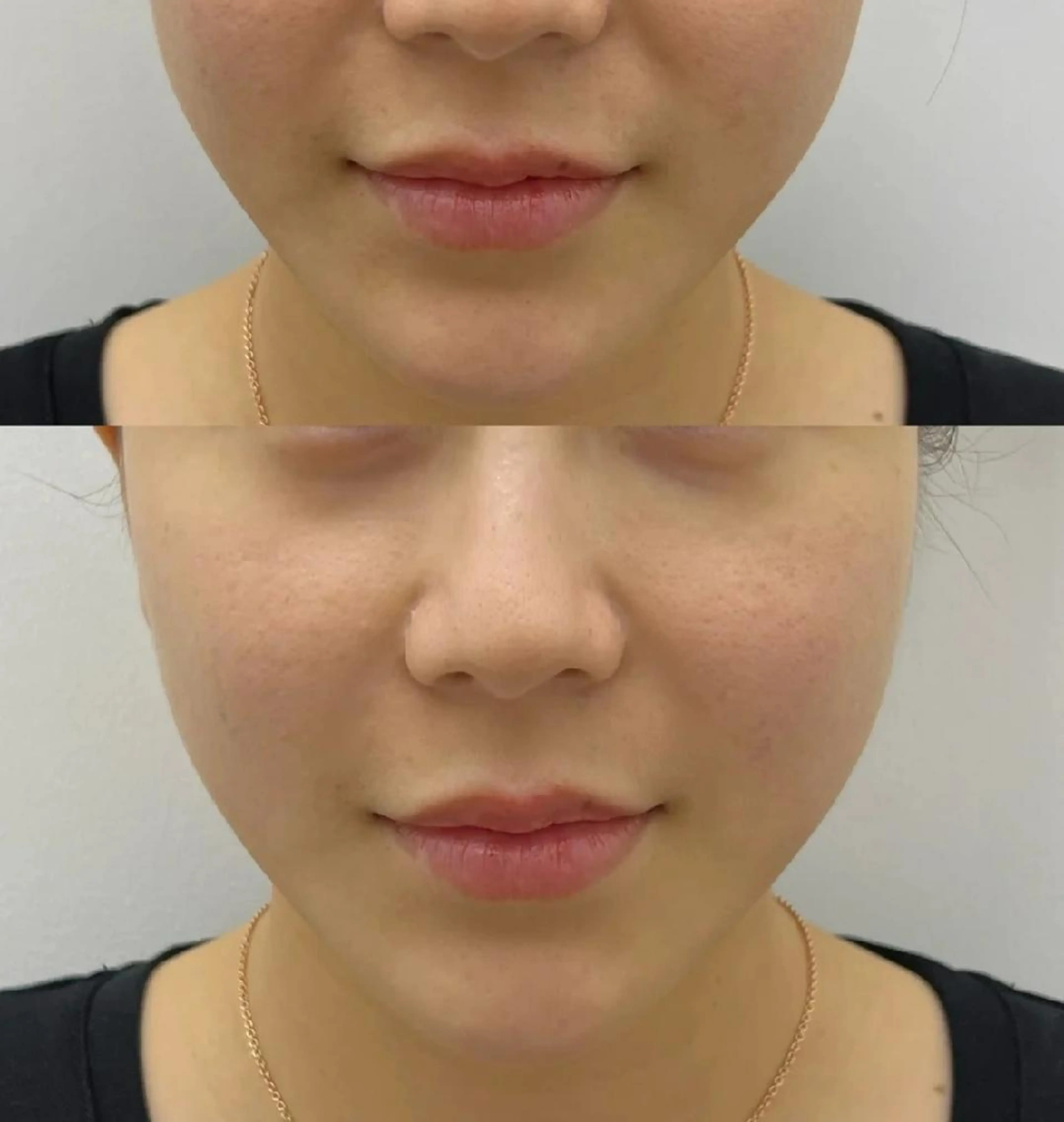 エステ aliaハーブ水光店 エステティシャン募集のエステ・リラクイメージ