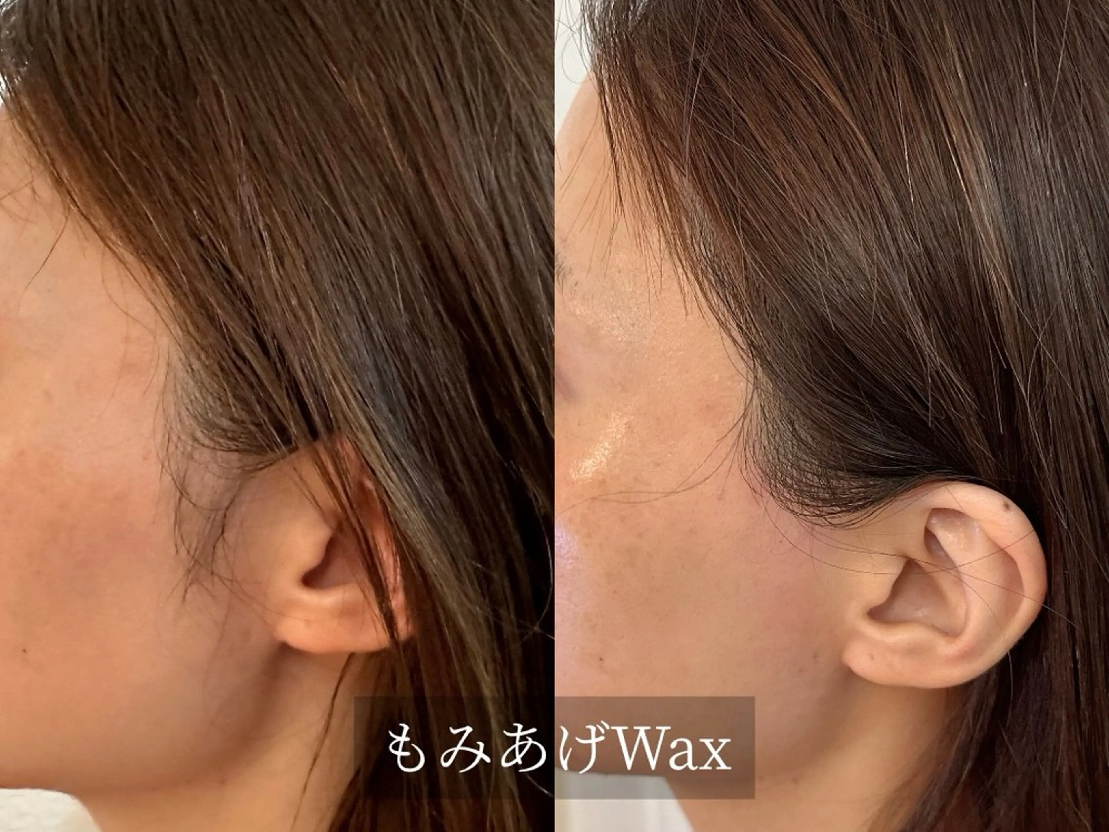 脱毛 プライベート脱毛サロン　Arum所属・脱毛サロン Arumのエステ・リラクイメージ