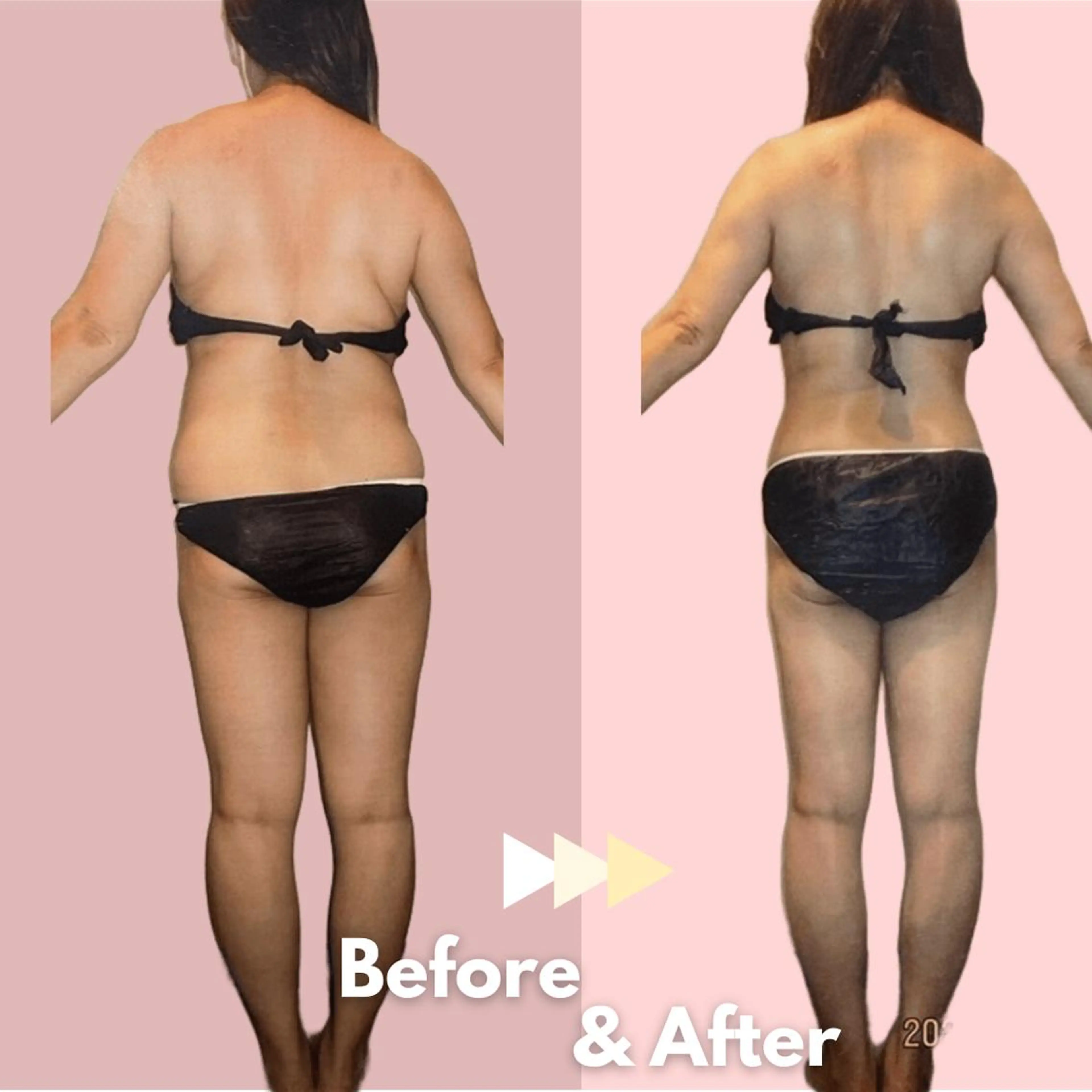 全身痩身✨ キレイサローネ池袋のエステ・リラクイメージ