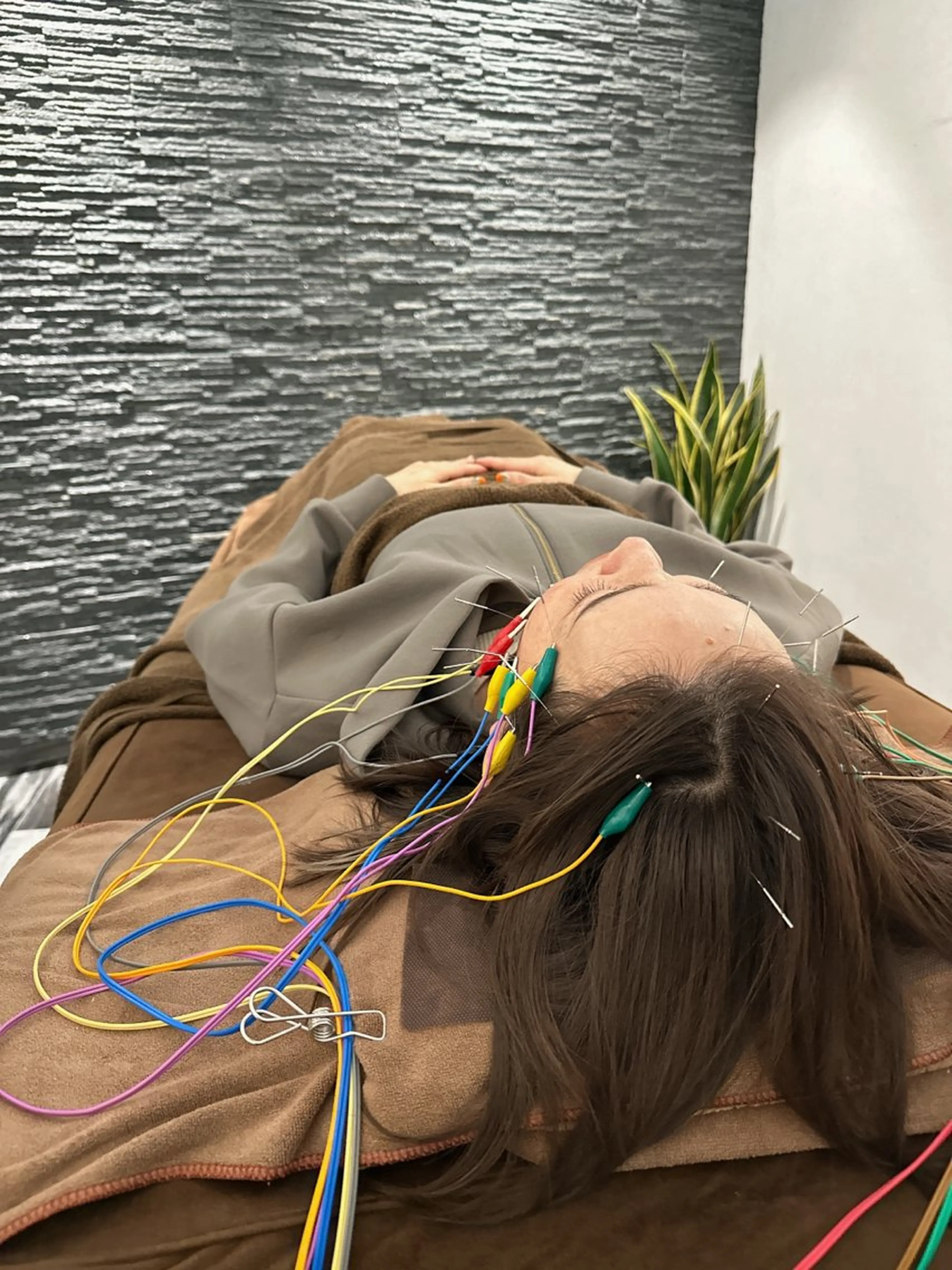 その他 小顔矯/美容鍼/鍼灸 BeauJuのその他イメージ