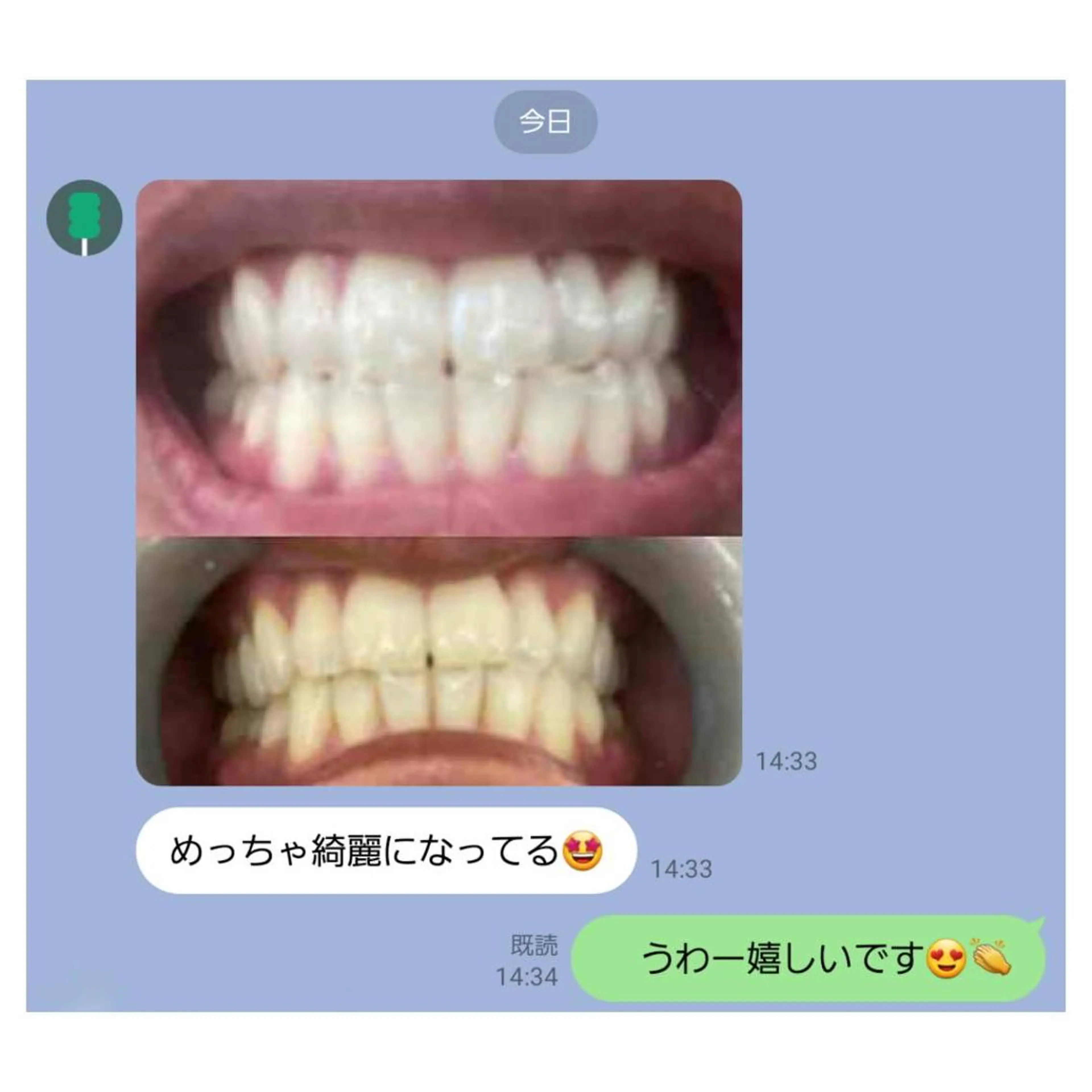 Melty 輝のその他イメージ