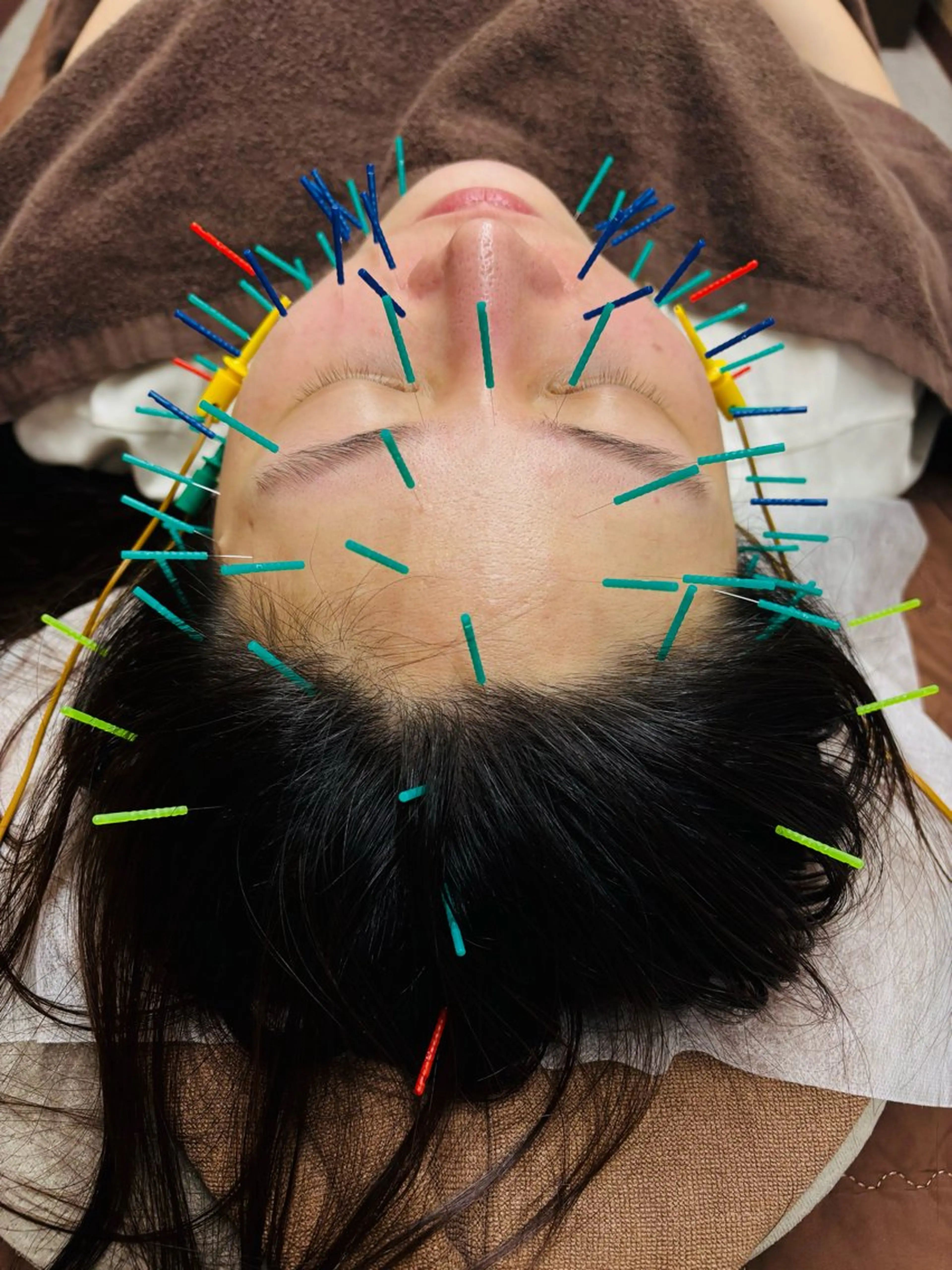 NO.10 整骨院のエステ・リラクイメージ