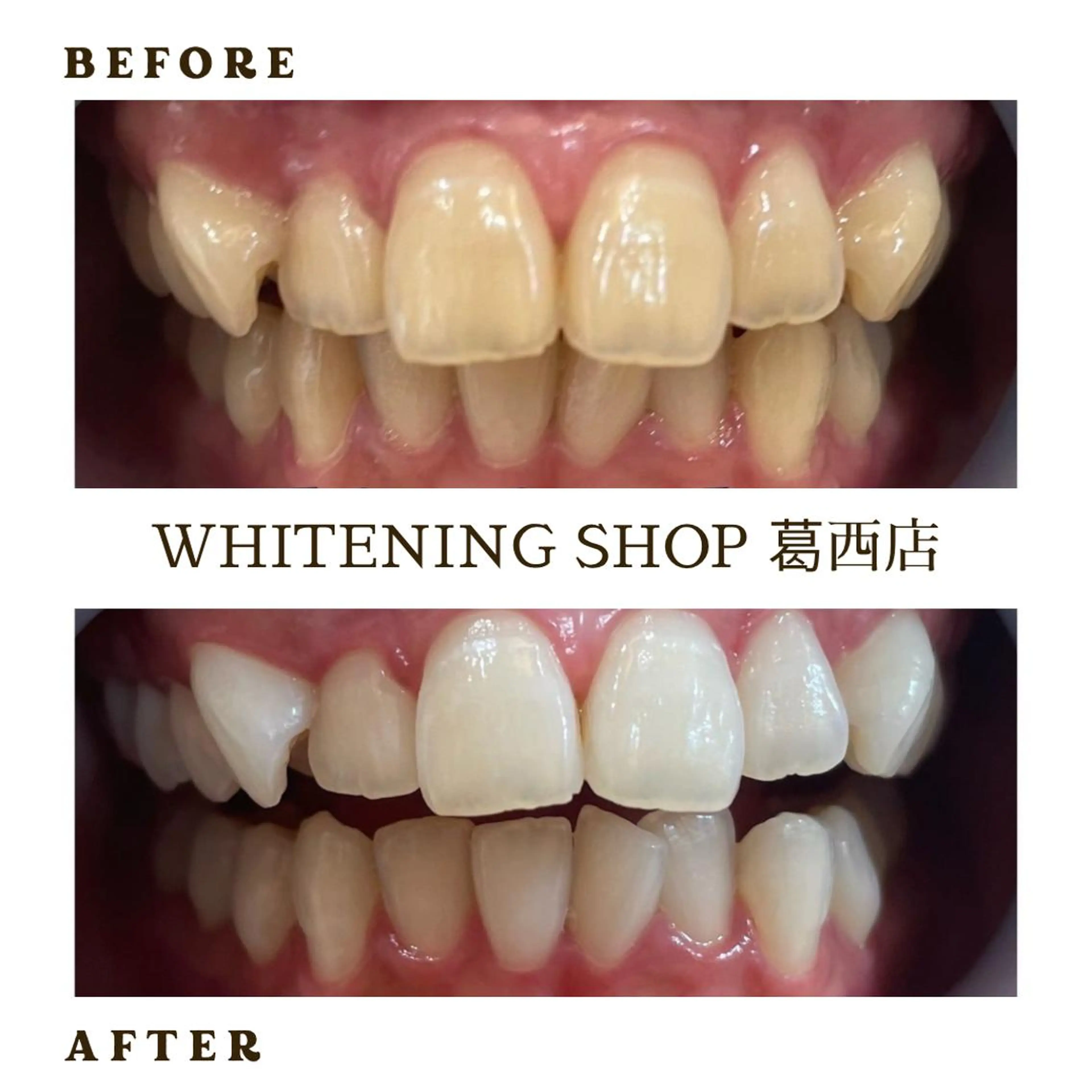 メンズ その他 ホワイトニング ショップ葛西店のその他イメージ