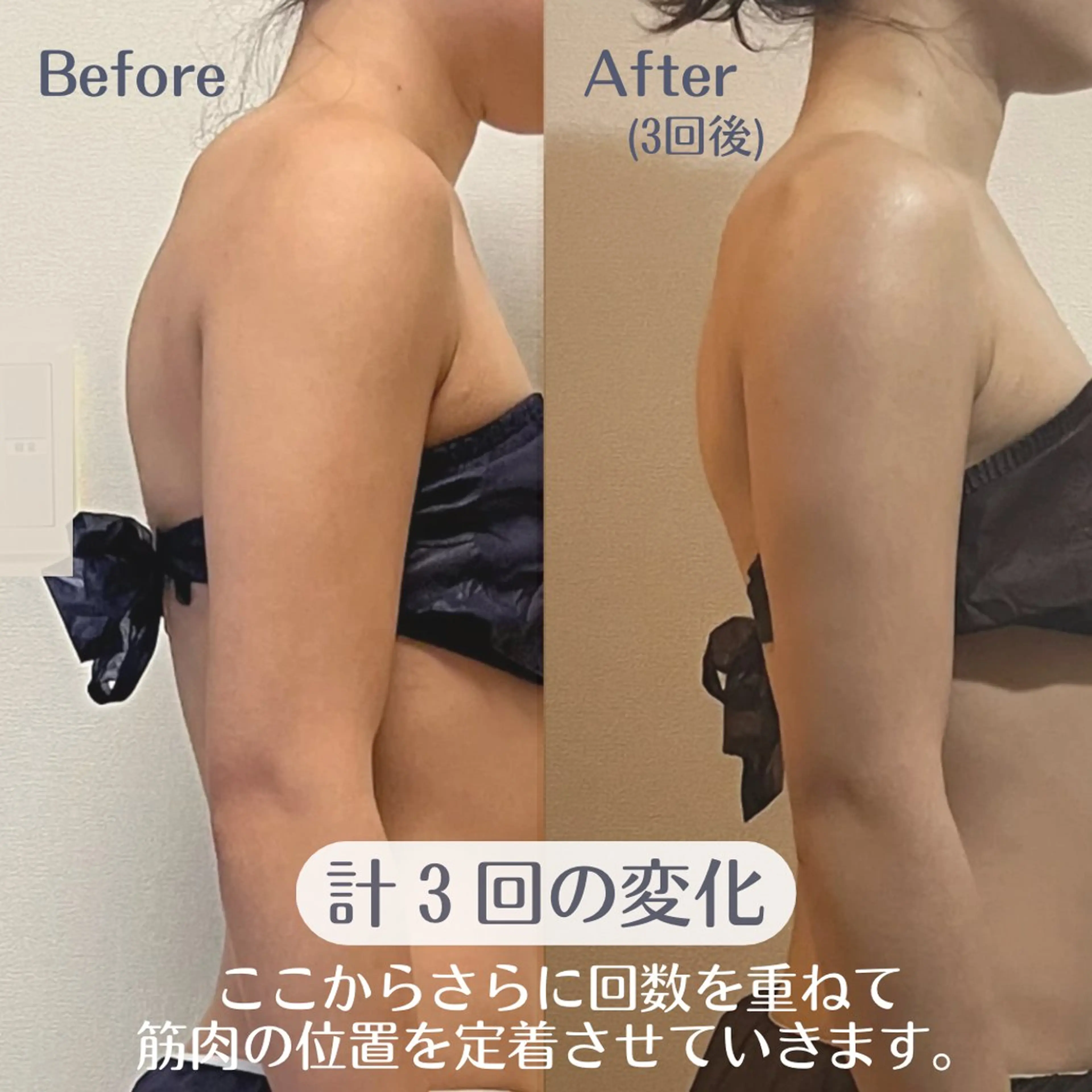 小顔矯正/骨格矯正 AKANEのエステ・リラクイメージ