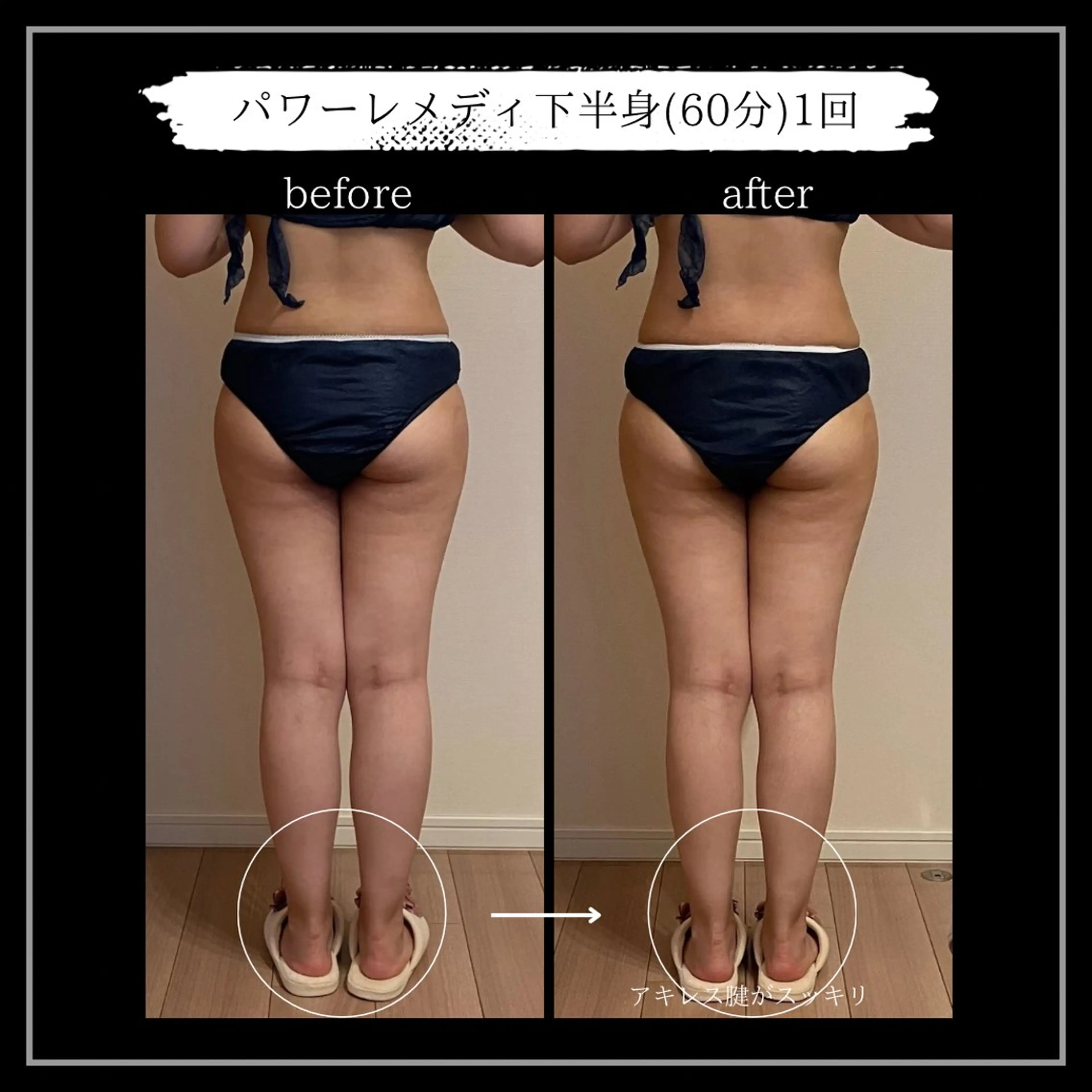 オフ:オン 全身筋膜マッサージのエステ・リラクイメージ