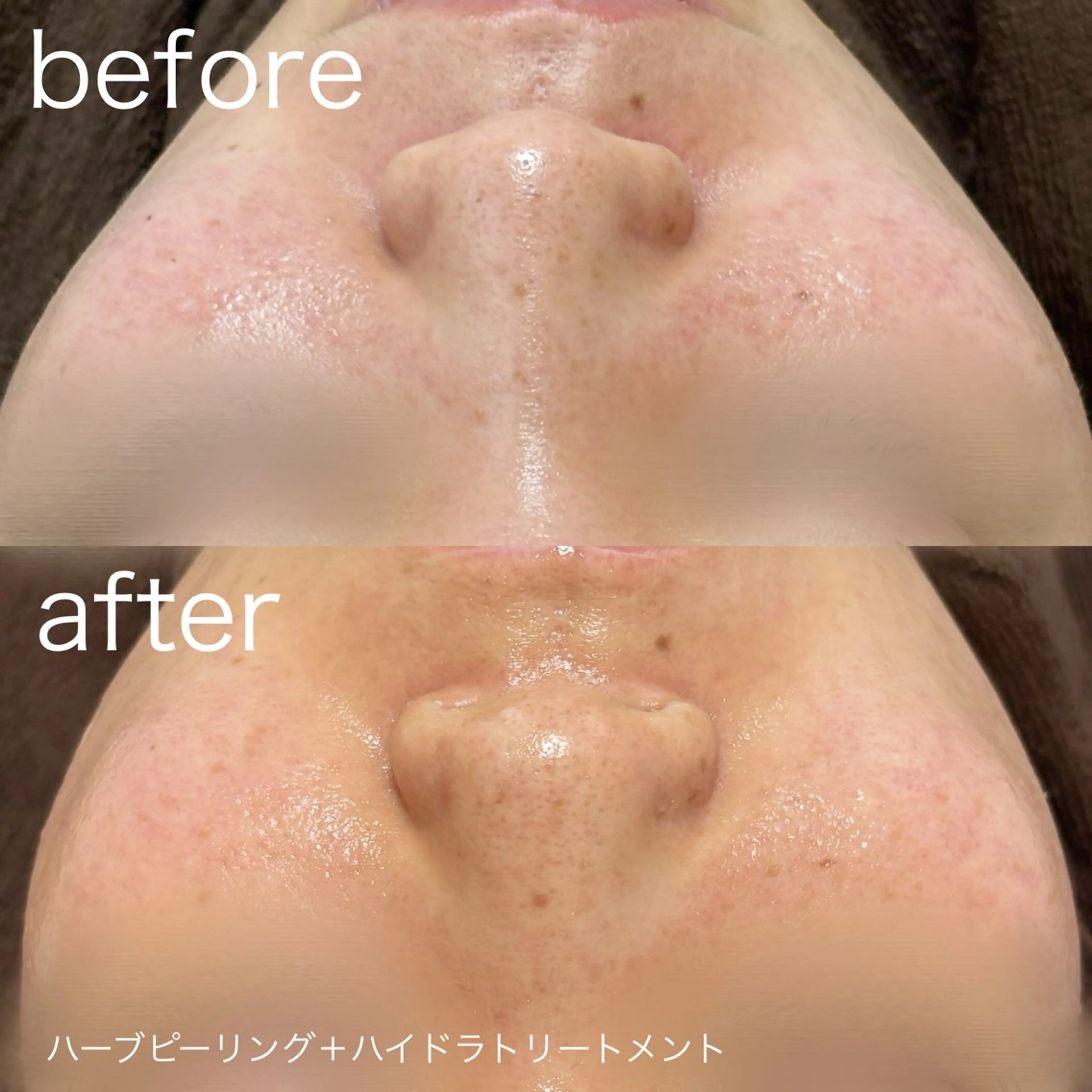 その他 lulularico Yuのエステ・リラクイメージ