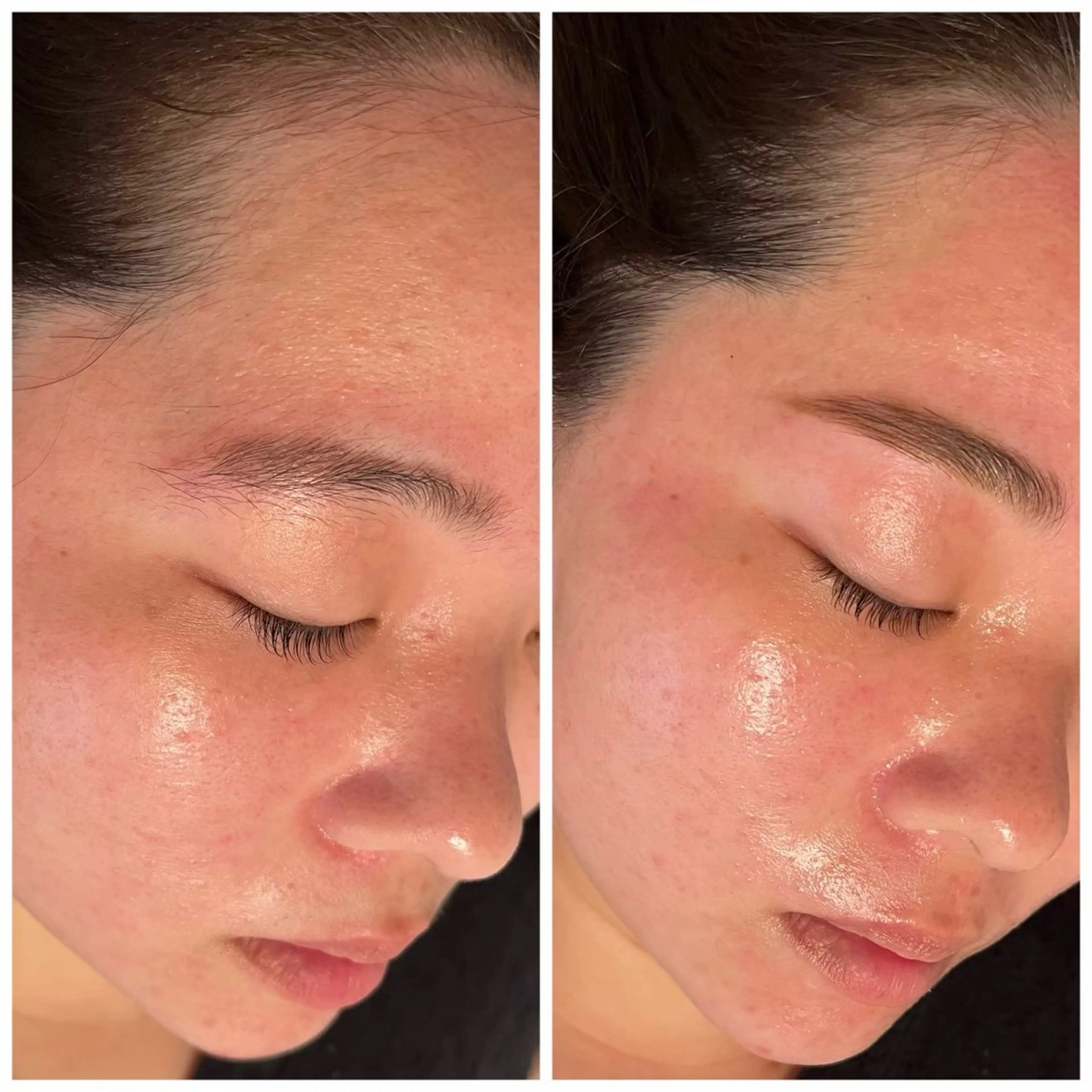 アイブロウ ハリウッドブロウリフト Ｂ&H所属・頭痛肩こり改善/小顔 サロンB&H心斎橋のエステ・リラクイメージ