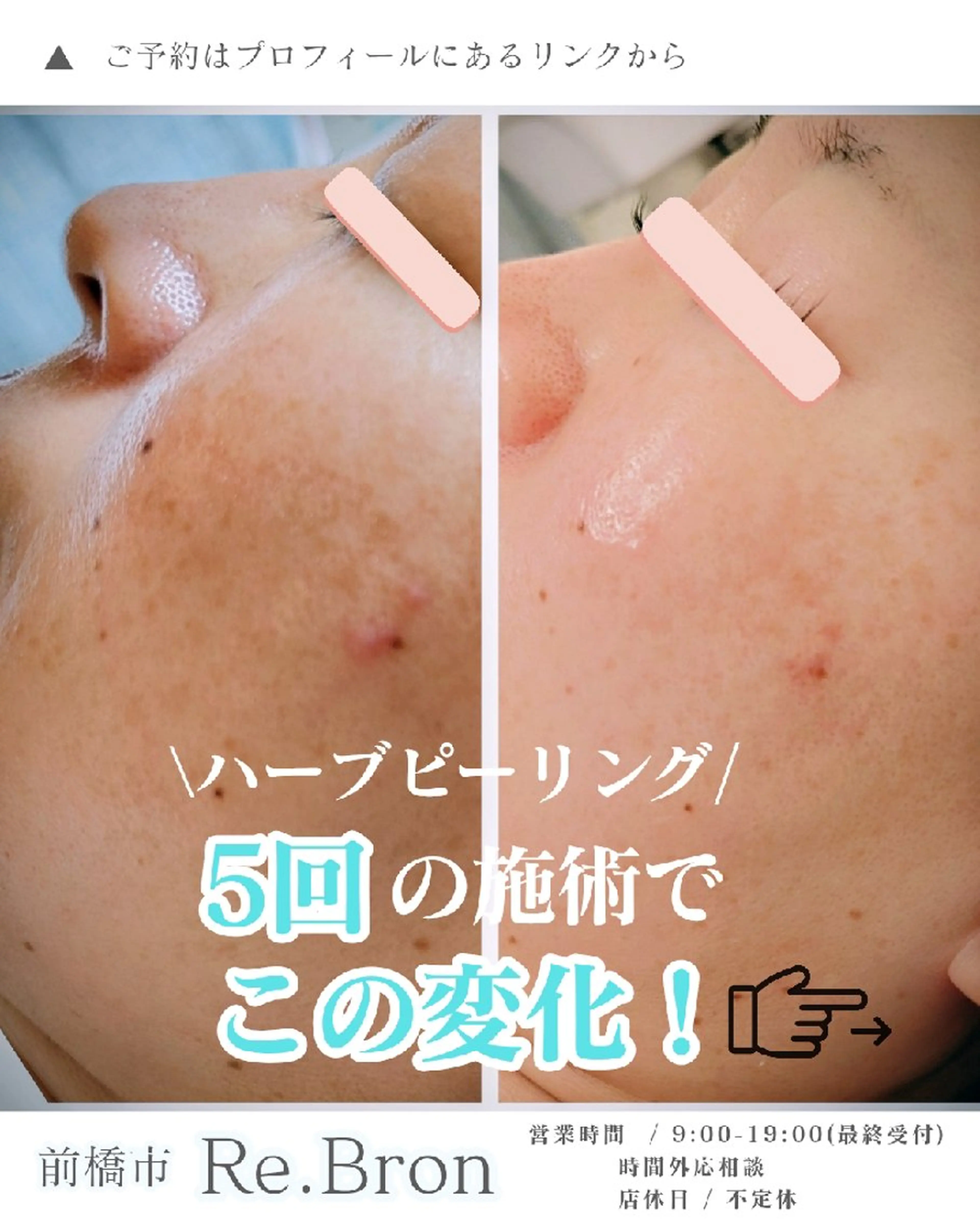 エステ リラク たるみ・ くすみ シミ・ニキビ肌改善のエステ・リラクイメージ