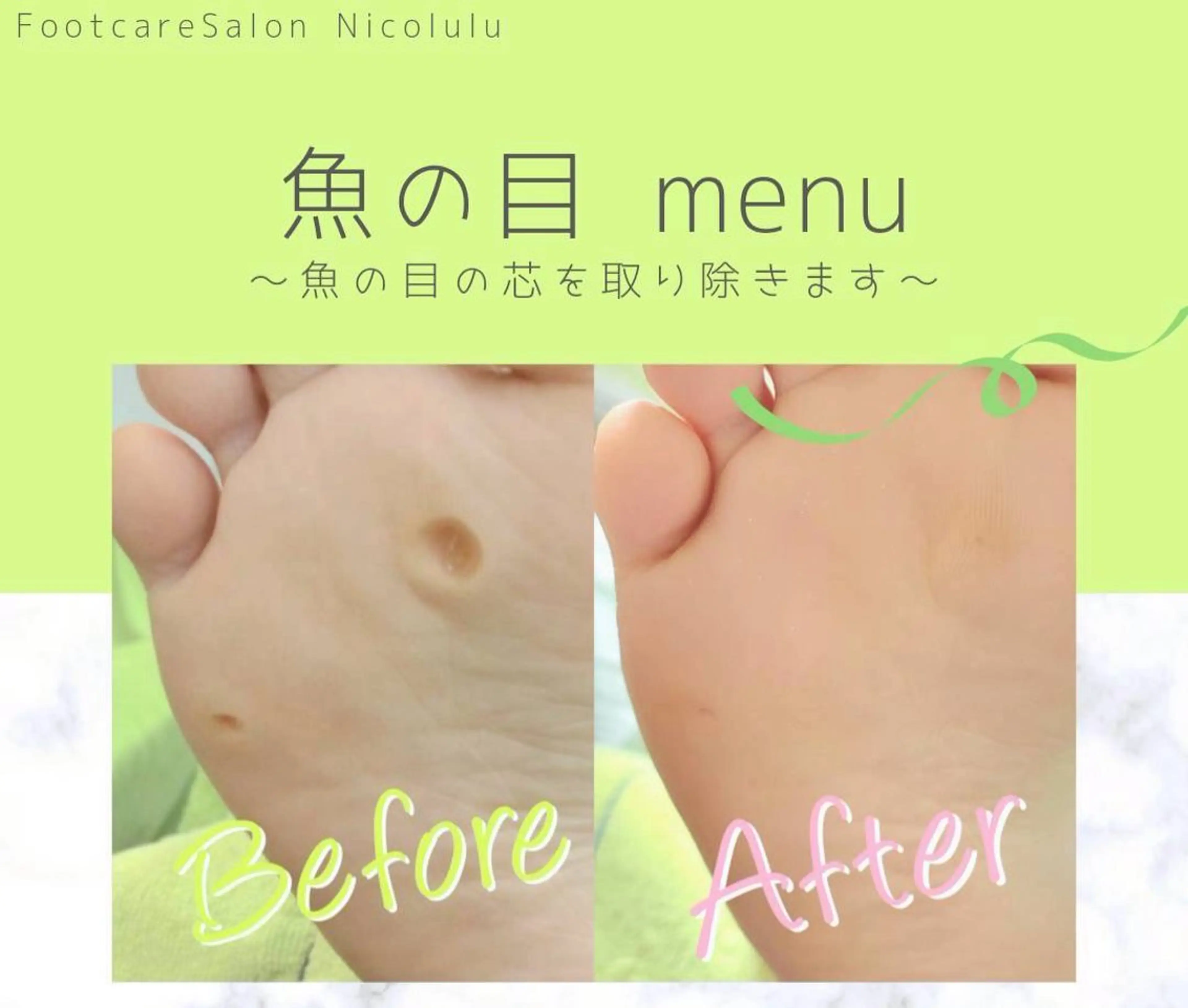 メンズ リラク 足トラブル専門 ニコルル金沢のエステ・リラクイメージ