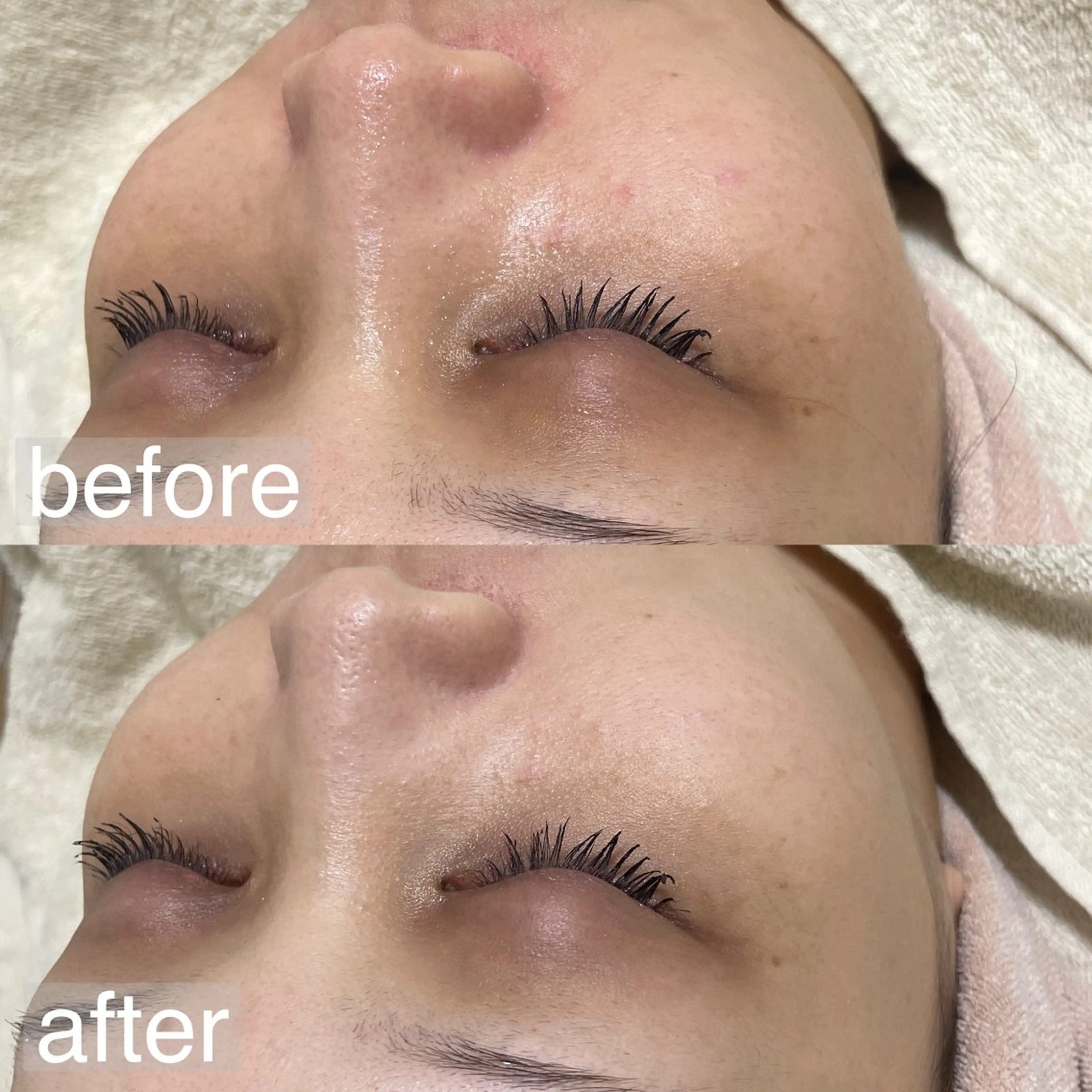 エステ WAX脱毛/肌質改善 眉毛とお肌のサロンのエステ・リラクイメージ