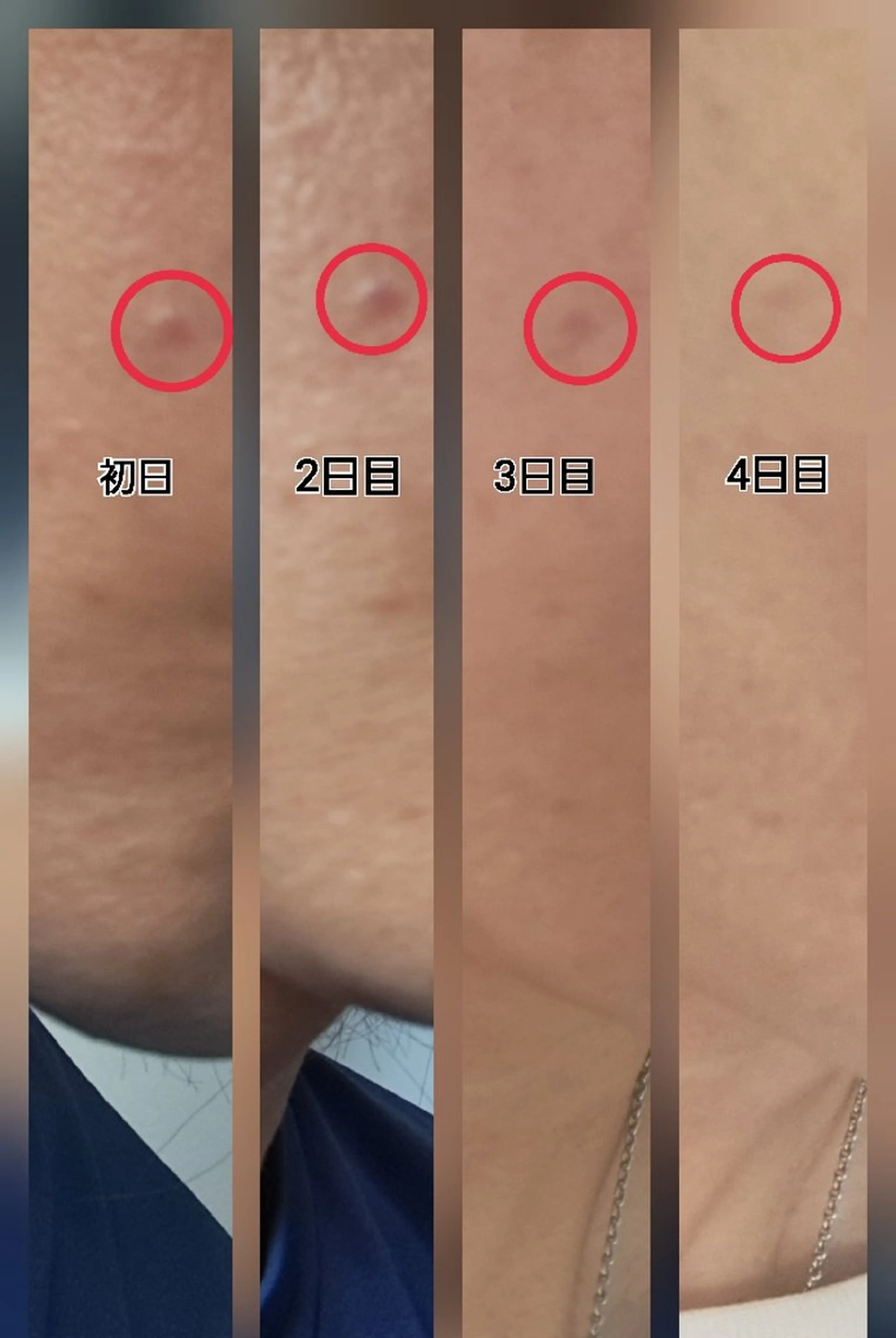 肌質改善サロン Rosalieのエステ・リラクイメージ