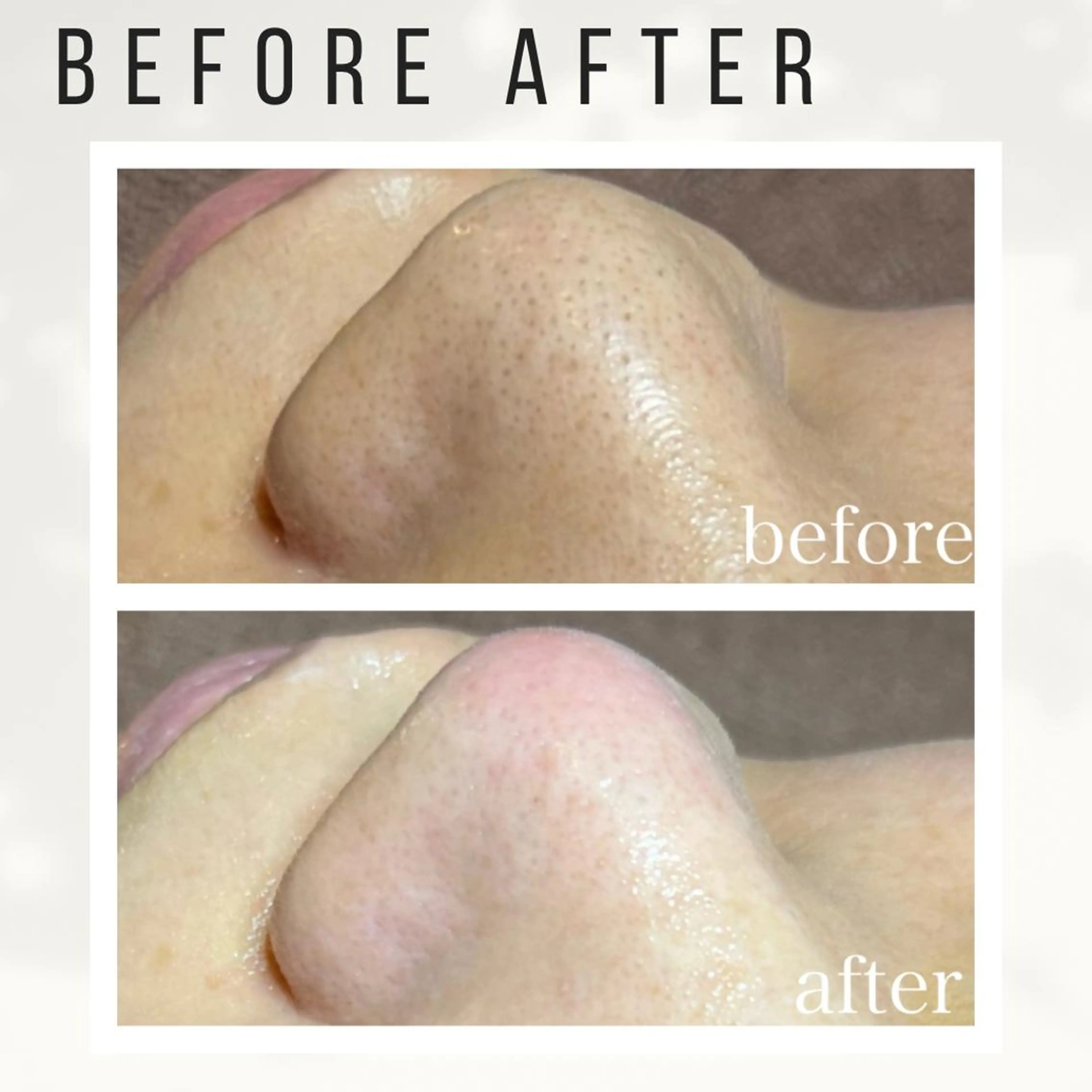 大人女性のための 肌管理サロン　ハピーのエステ・リラクイメージ