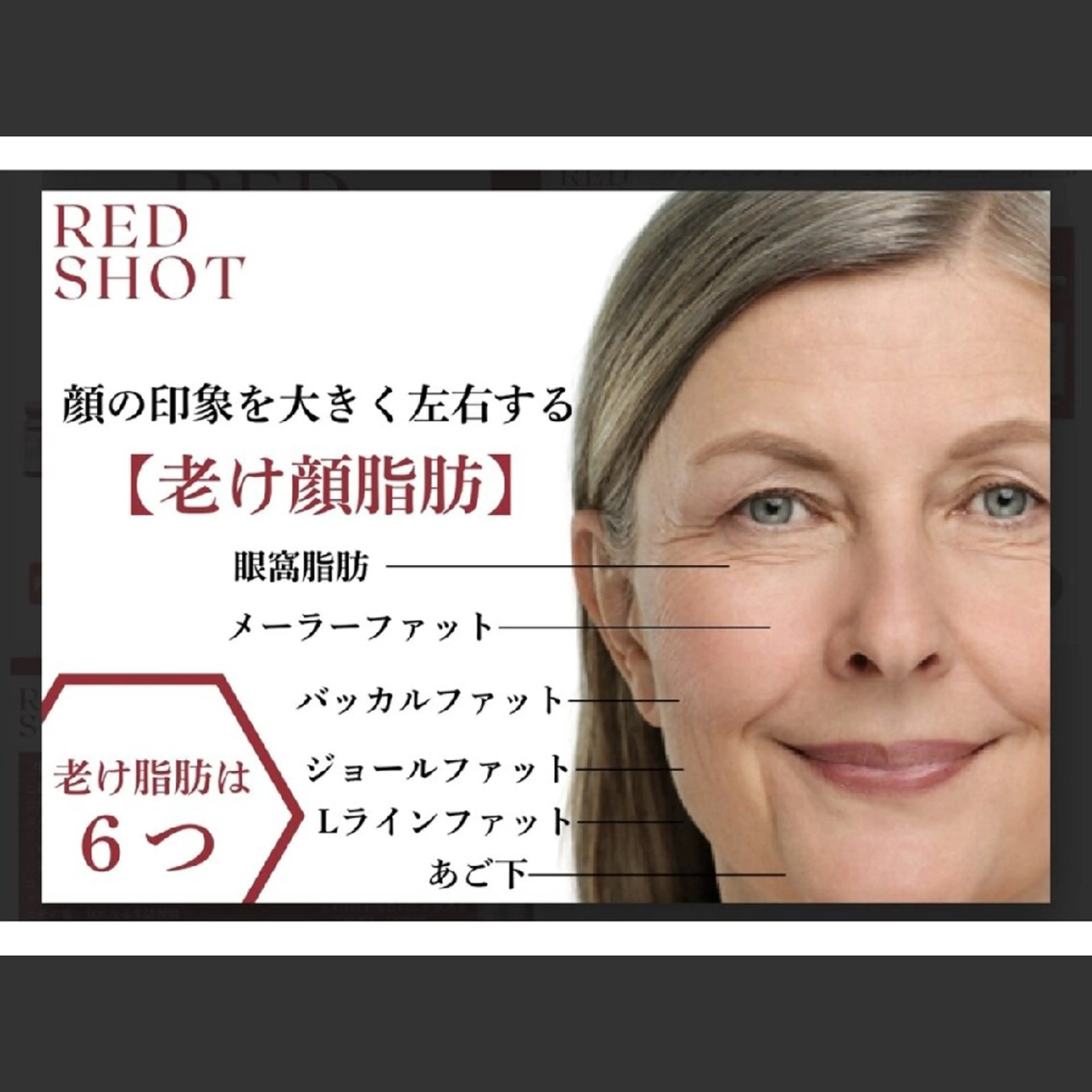 エステ MY SPACE 横浜店サロンのエステ・リラクイメージ