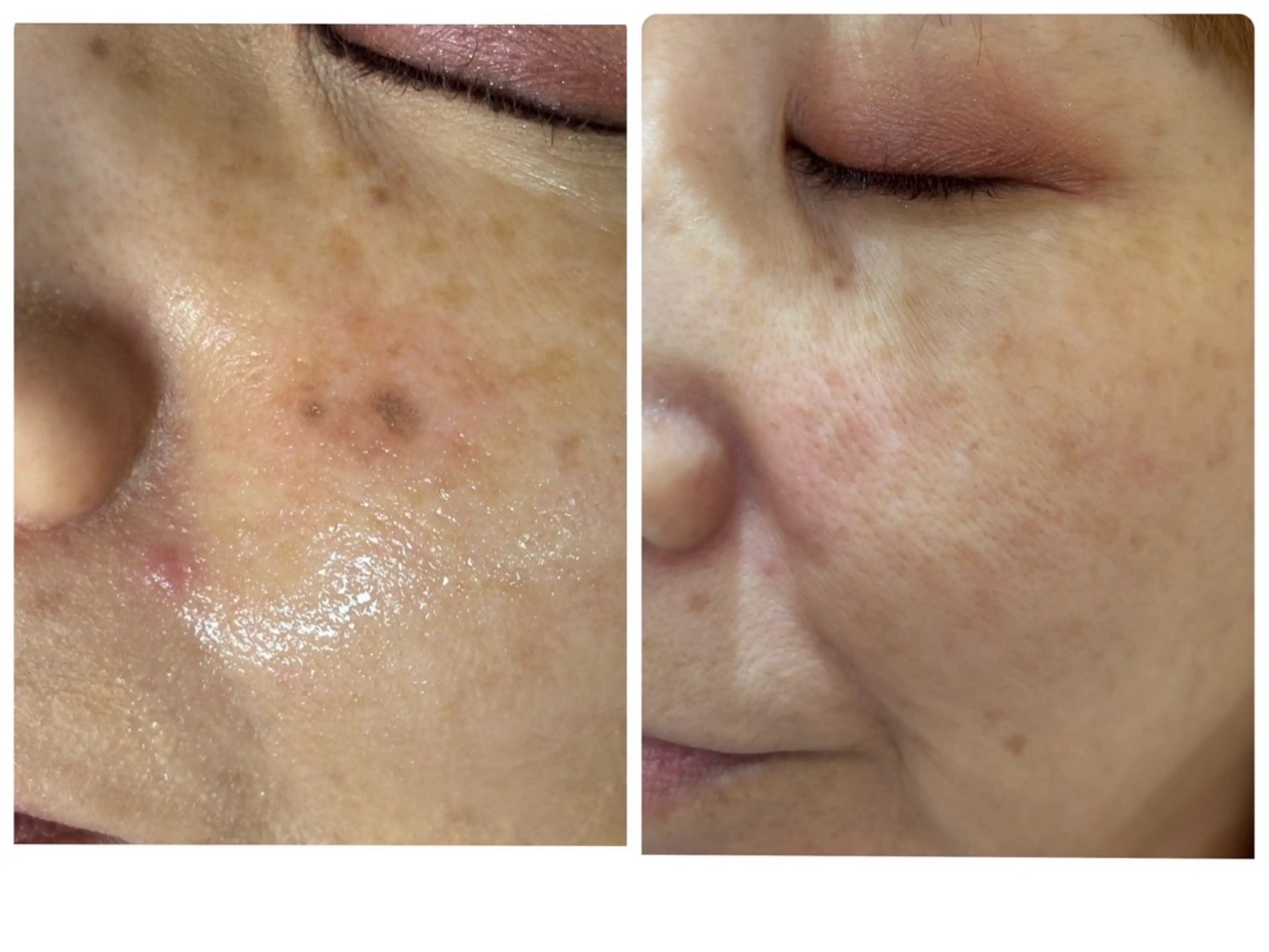 サロンドヂュエル 川本千恵のその他イメージ