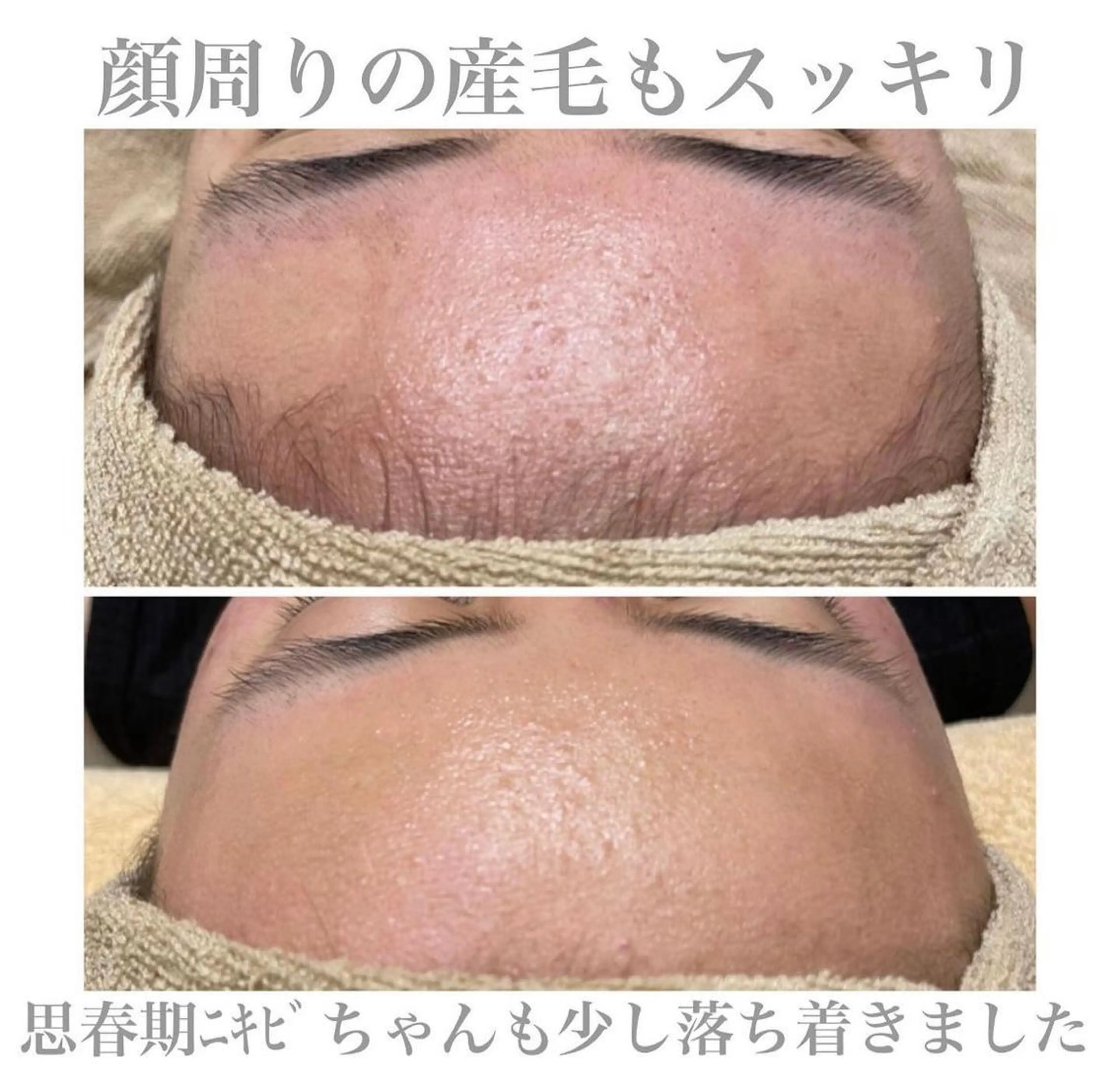 エステサロン Mi-mi.iのエステ・リラクイメージ