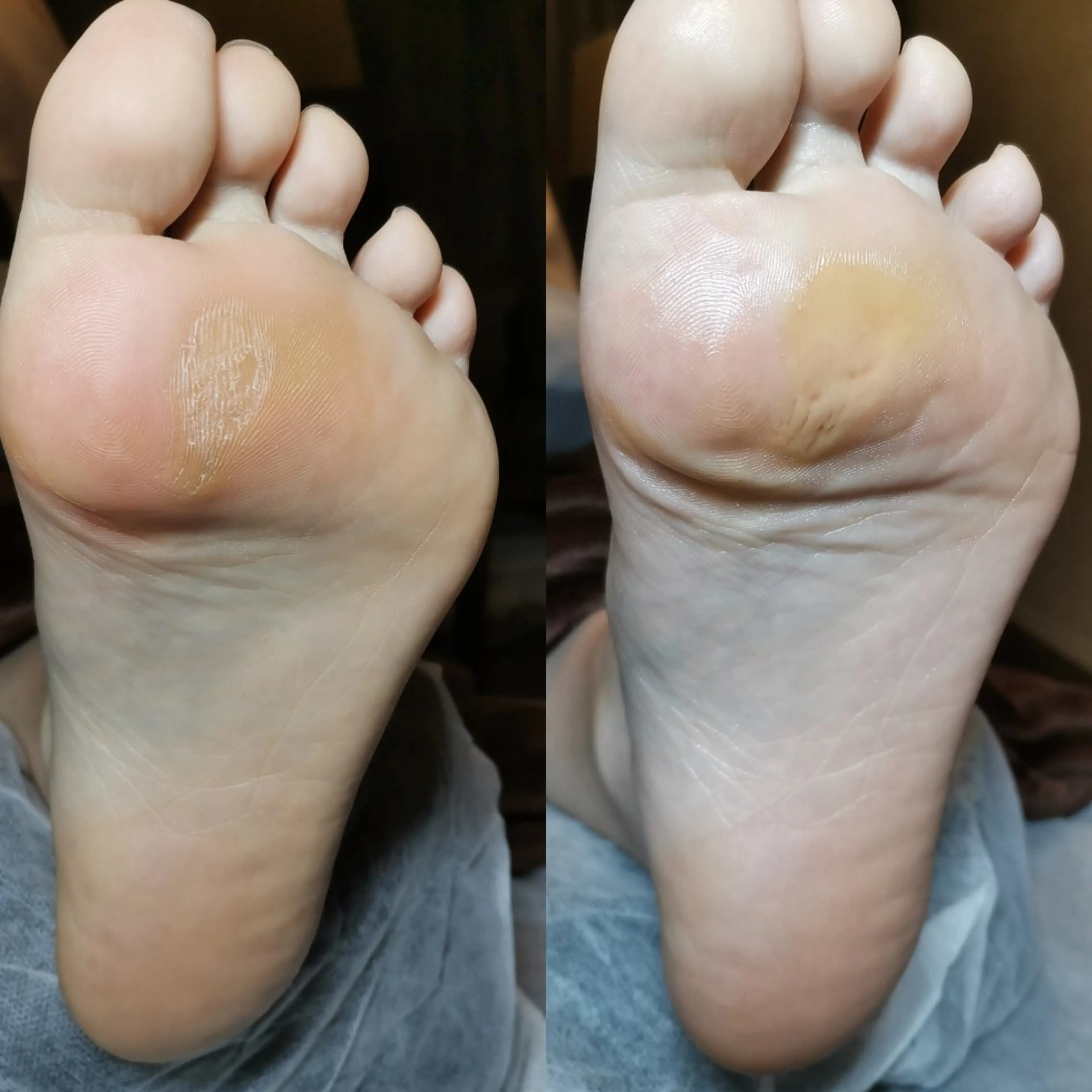 ネイル ROUN' 齋藤のエステ・リラクイメージ