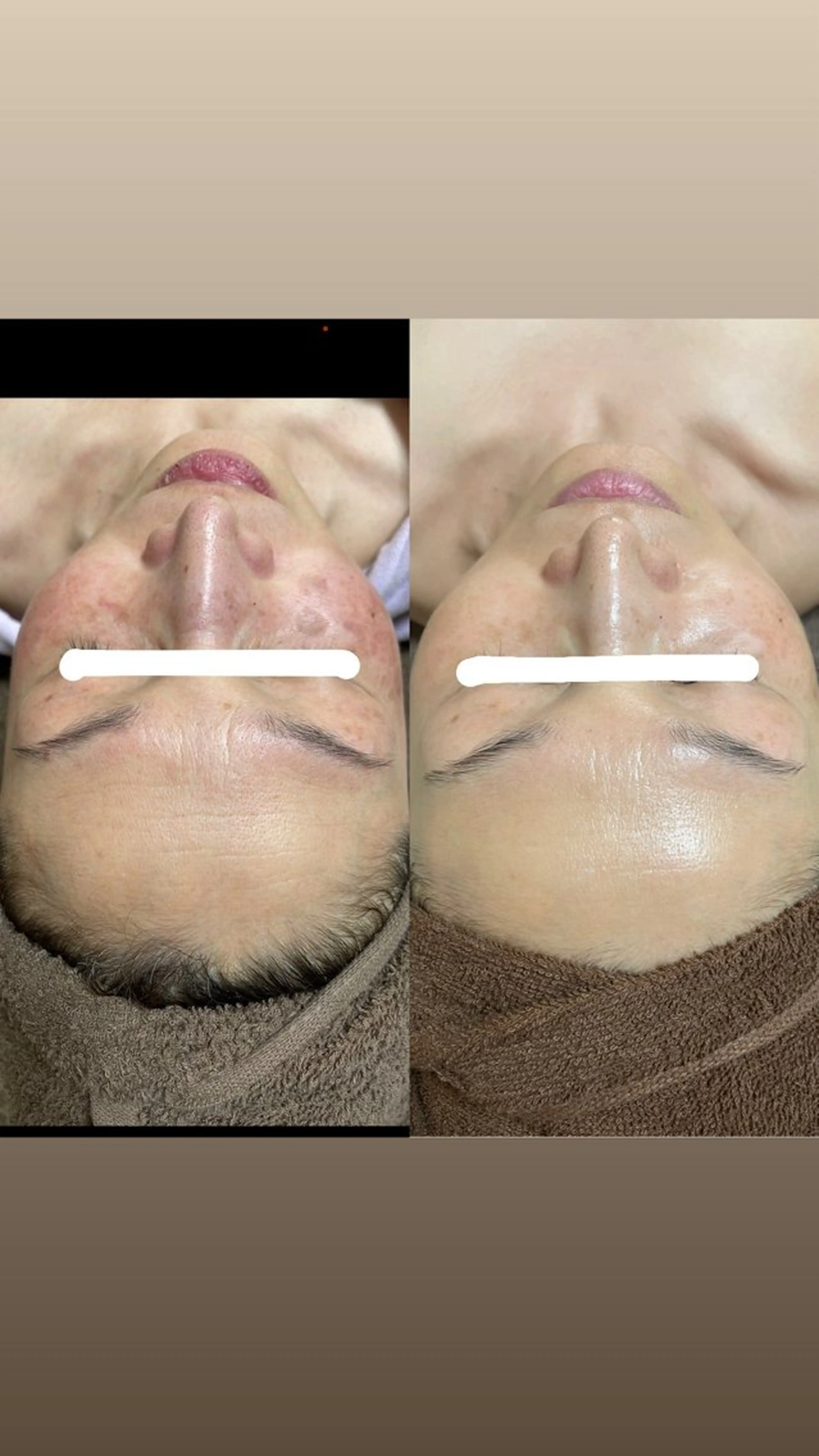 老化肌トラブル肌専門 Brillianceのエステ・リラクイメージ