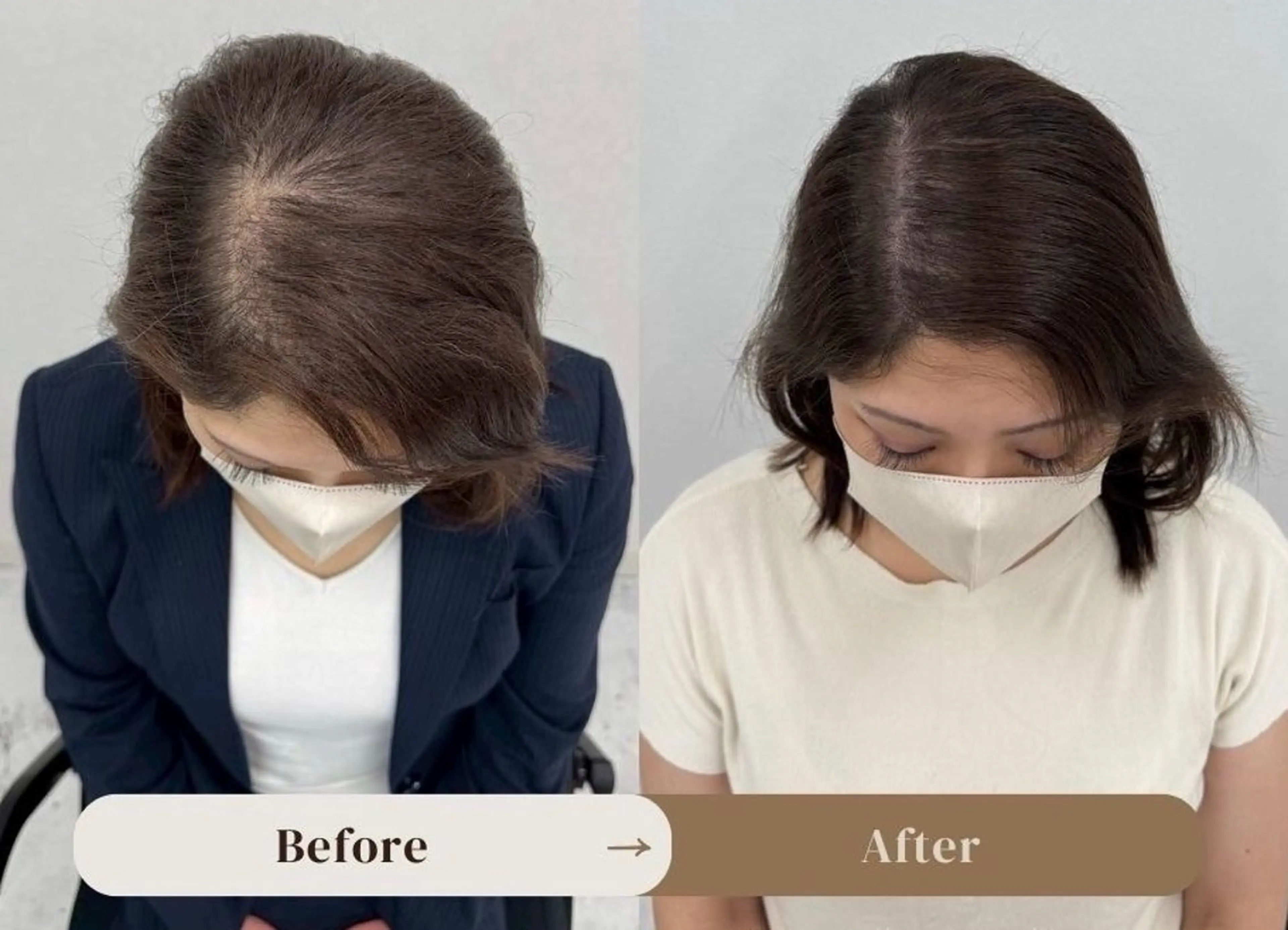 分け目のお悩み解消ヘアアート（SMP）の写真