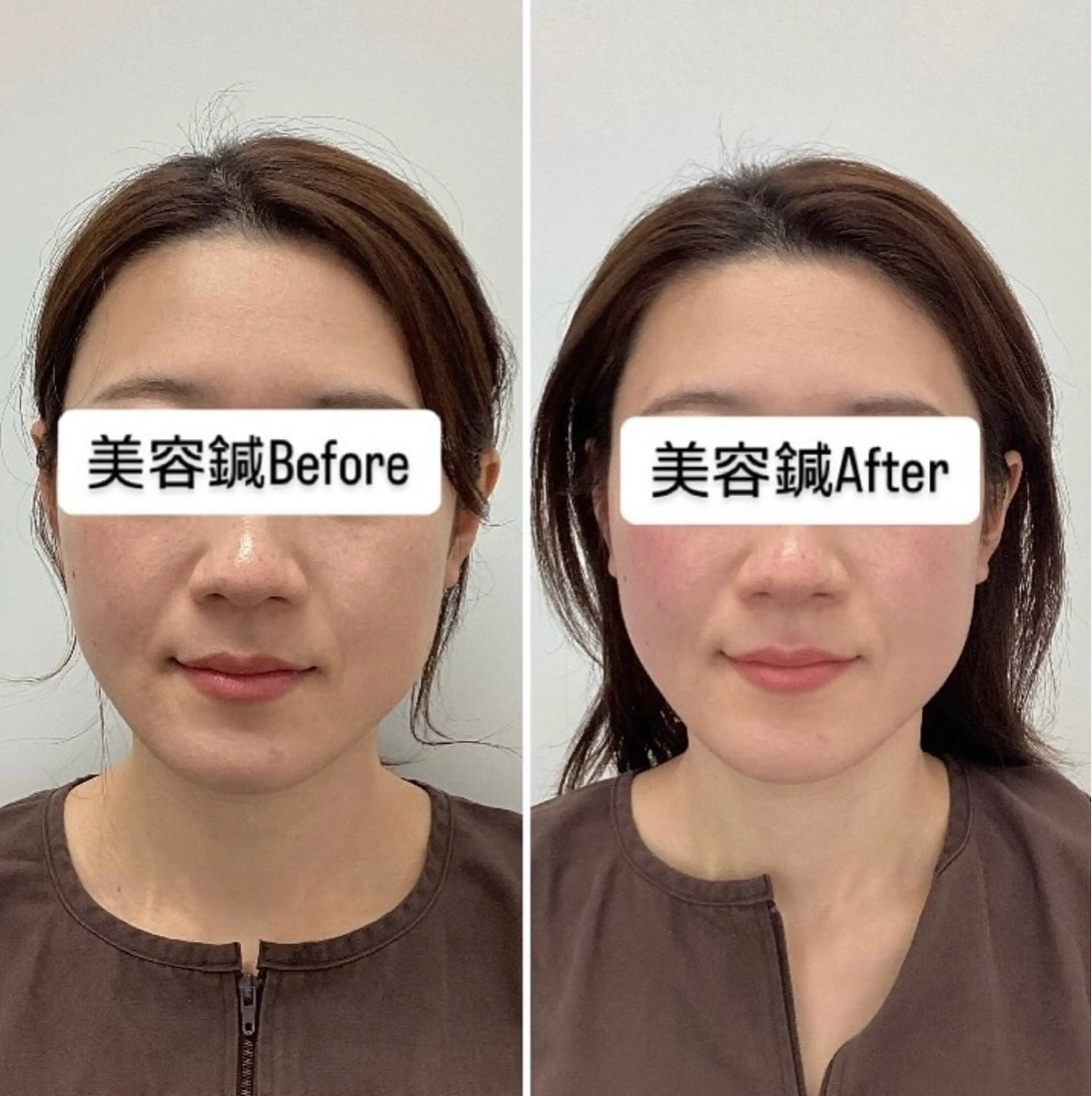 エステ リラク hari salon de off　美容鍼灸×小顔整体【ハリサロンドオフ】所属・美容鍼灸×小顔整体♡ ハリサロンドオフ堺東のその他イメージ