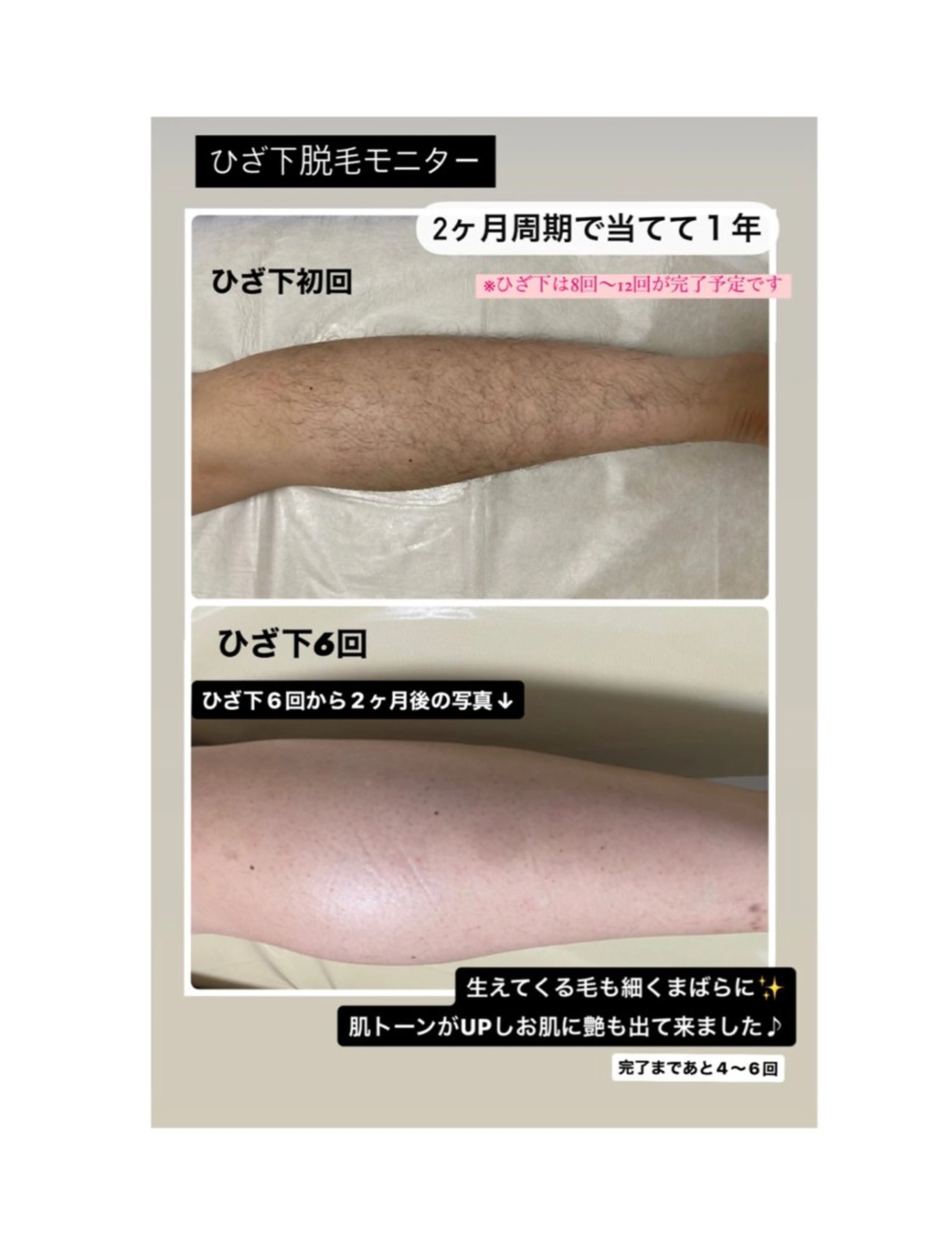 女性専用脱毛サロン エンジェルナンバーのエステ・リラクイメージ