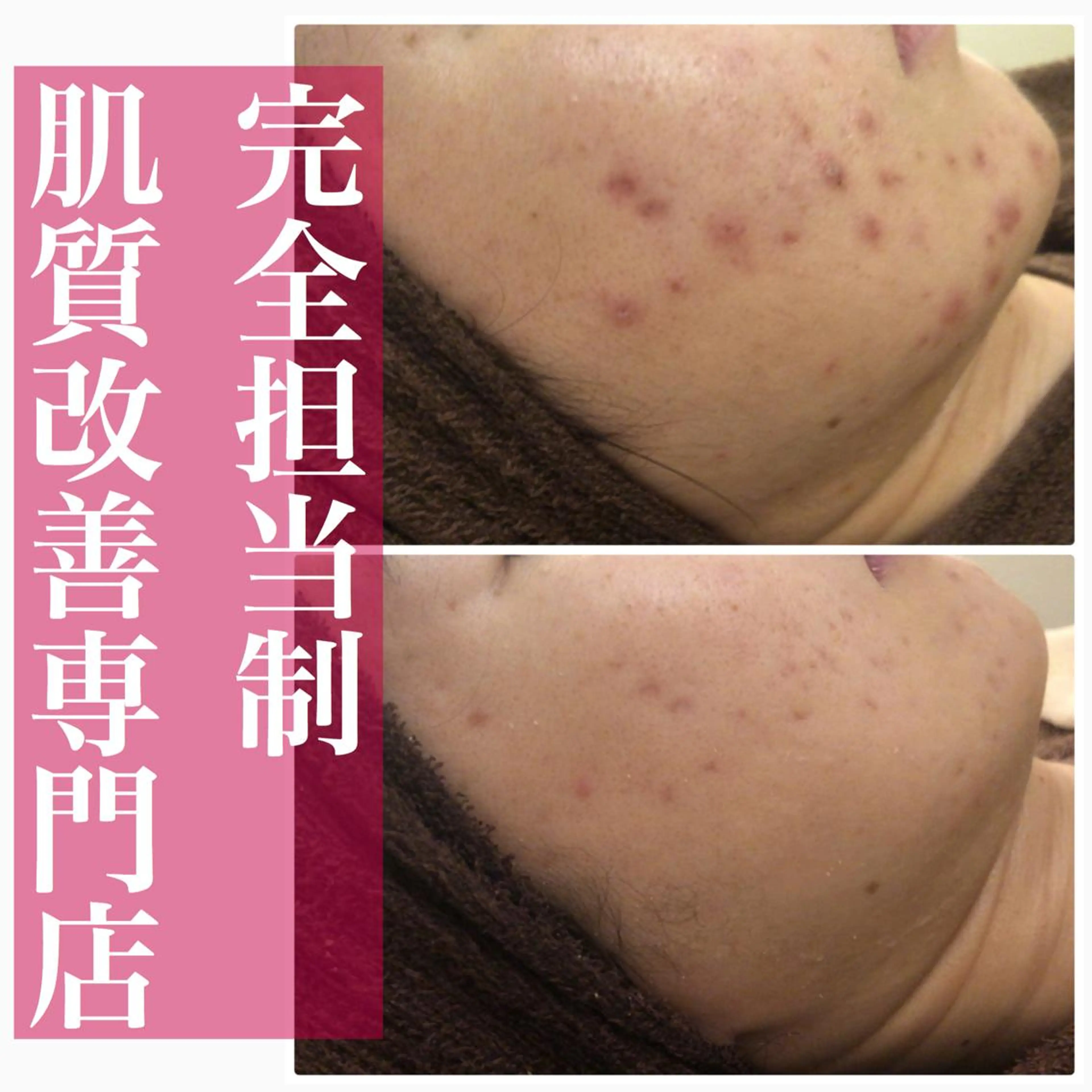 ミディアム カラー パーマ ヘアアレンジ メンズ キッズ ネイル マツエク・マツパ 赤色 ニキビ・肌質改善専門 ♡人生が変わるサロンのエステ・リラクイメージ