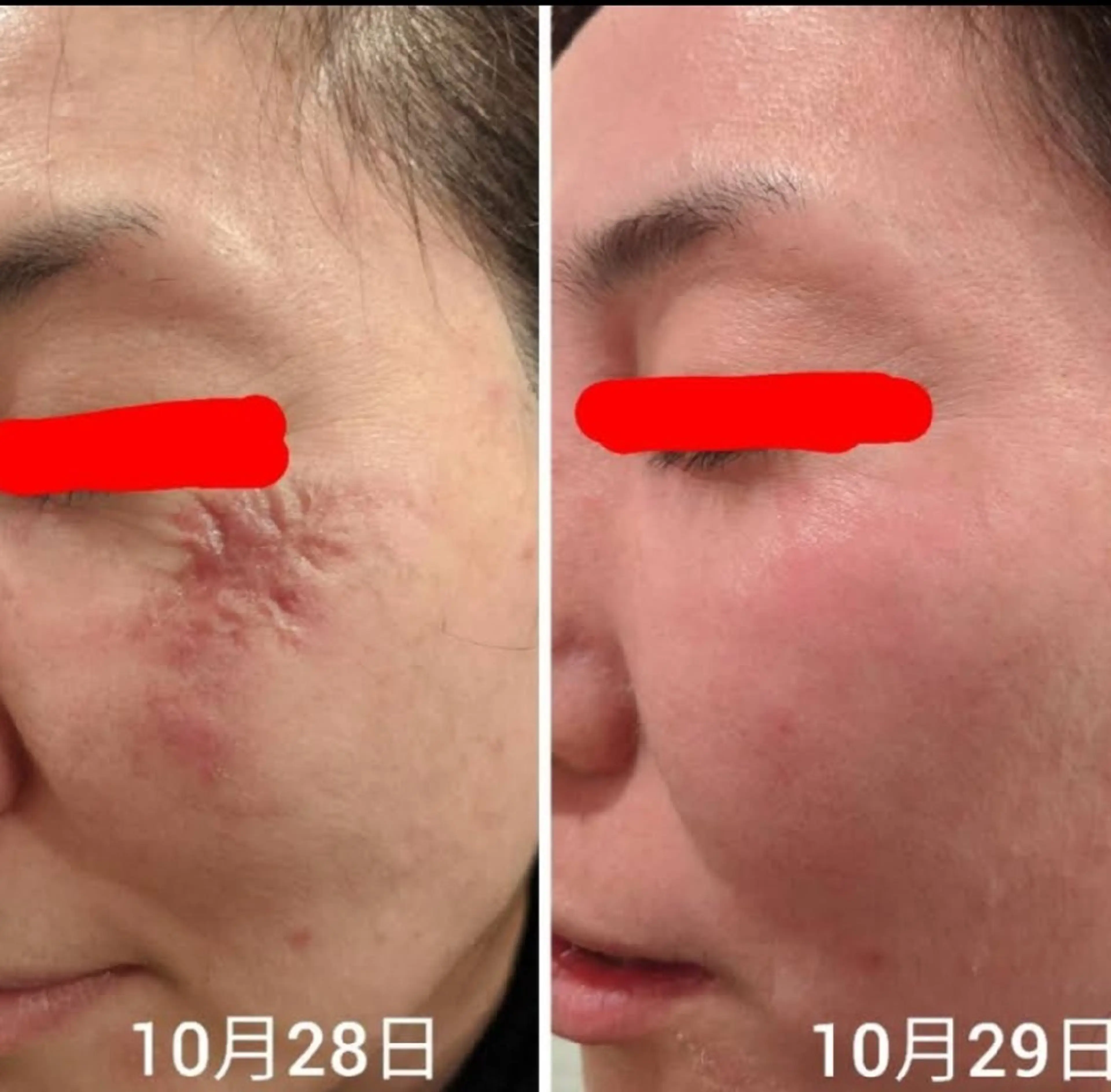 大阪大東市 / 体質・肌質改善サロン アンシャンテ所属・体質・肌質改善サロン アンシャンテのエステ・リラクイメージ