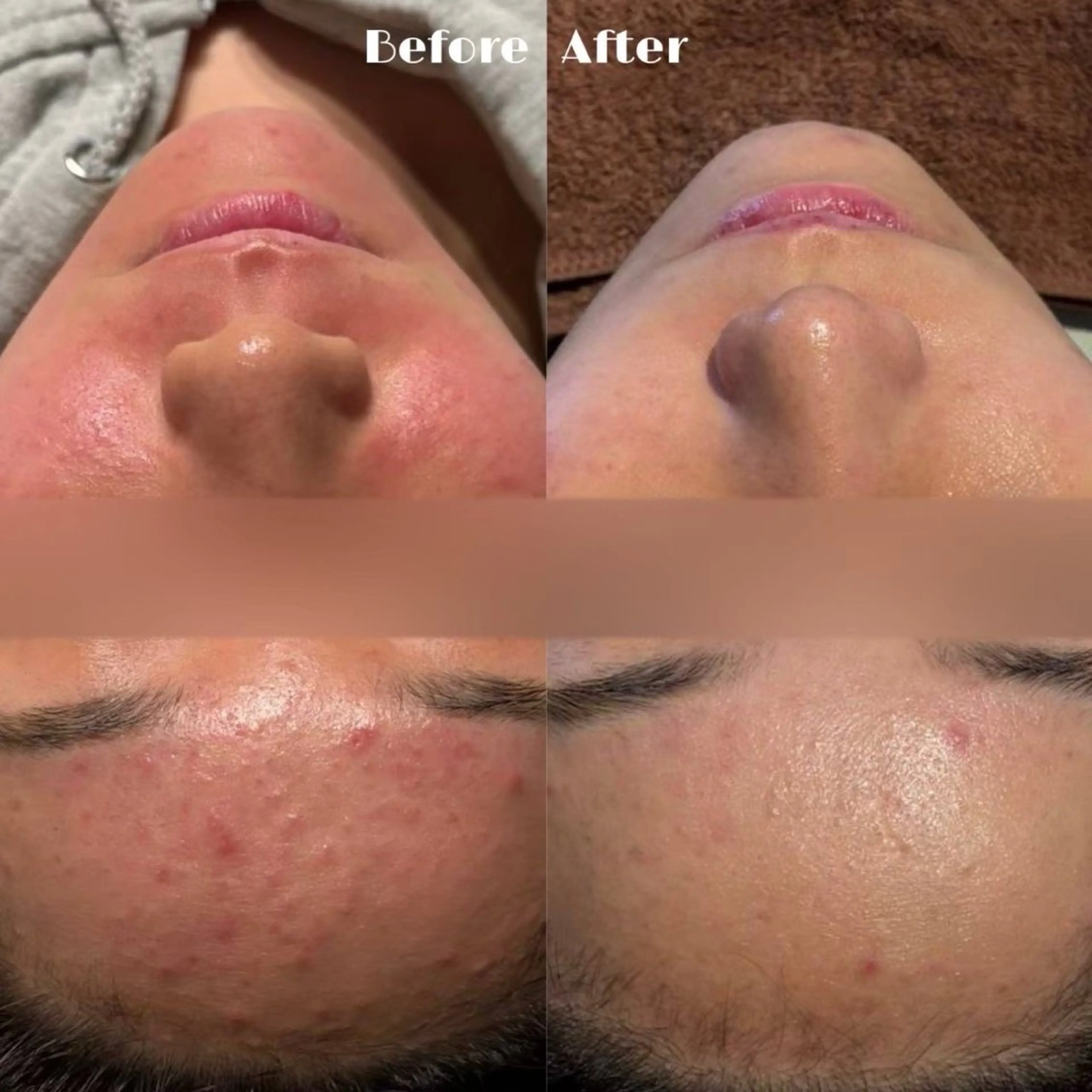 miyu 🩵のエステ・リラクイメージ