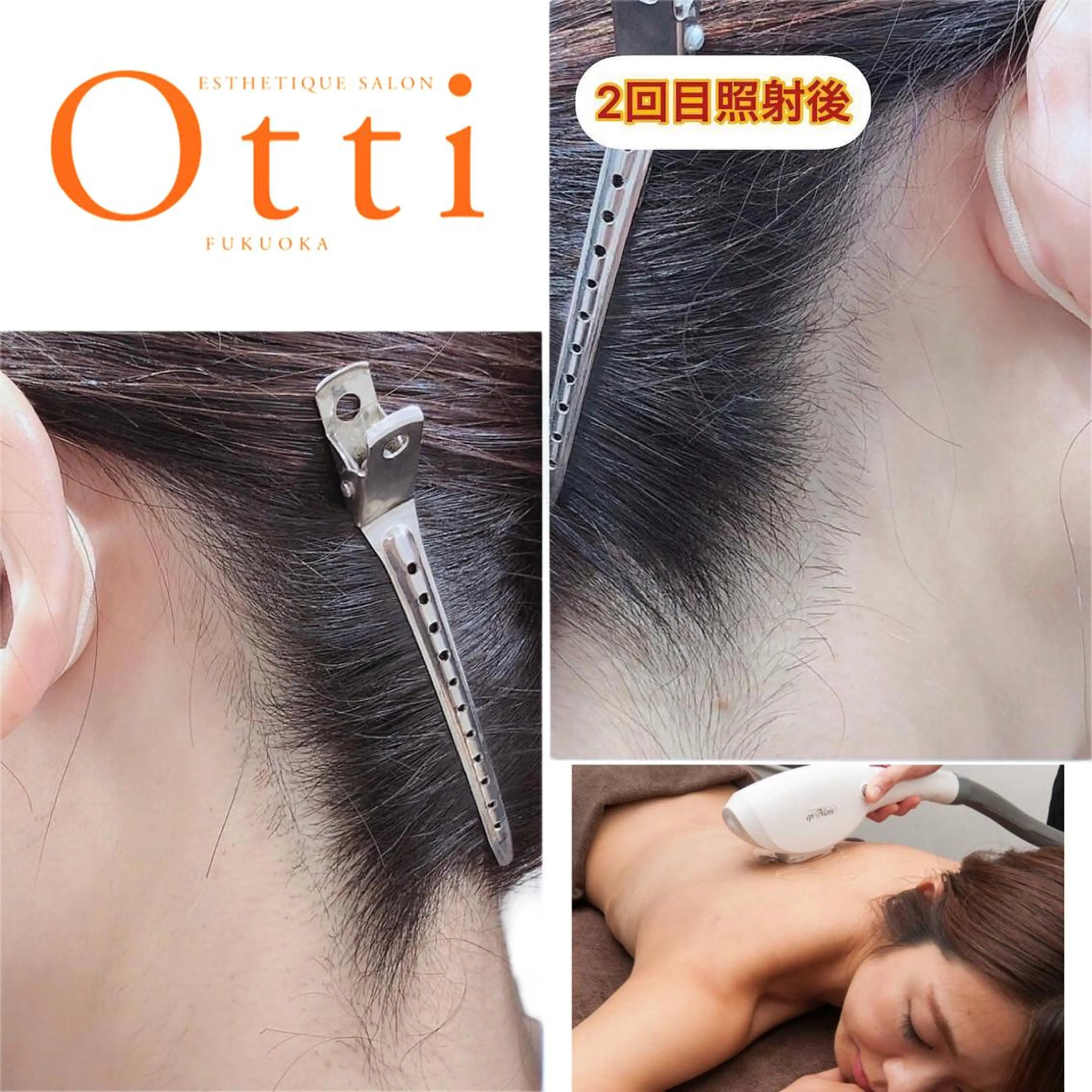 脱毛 エステ脱毛サロン Otti  オッティのエステ・リラクイメージ